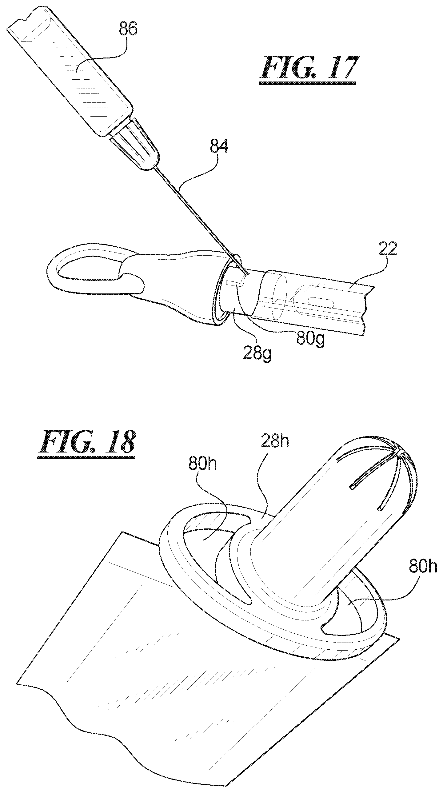 Patent US12403282 Figure 10 – Methods of making sleeved hydrophilic catheter assemblies