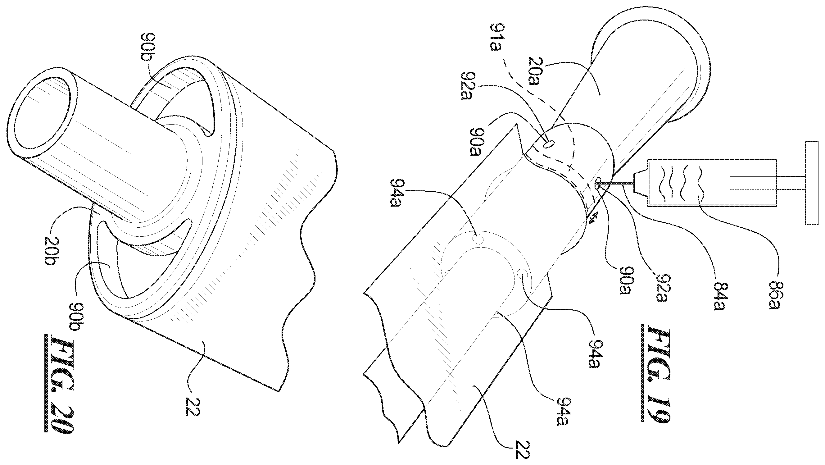 Patent US12403282 Figure 11 – Methods of making sleeved hydrophilic catheter assemblies