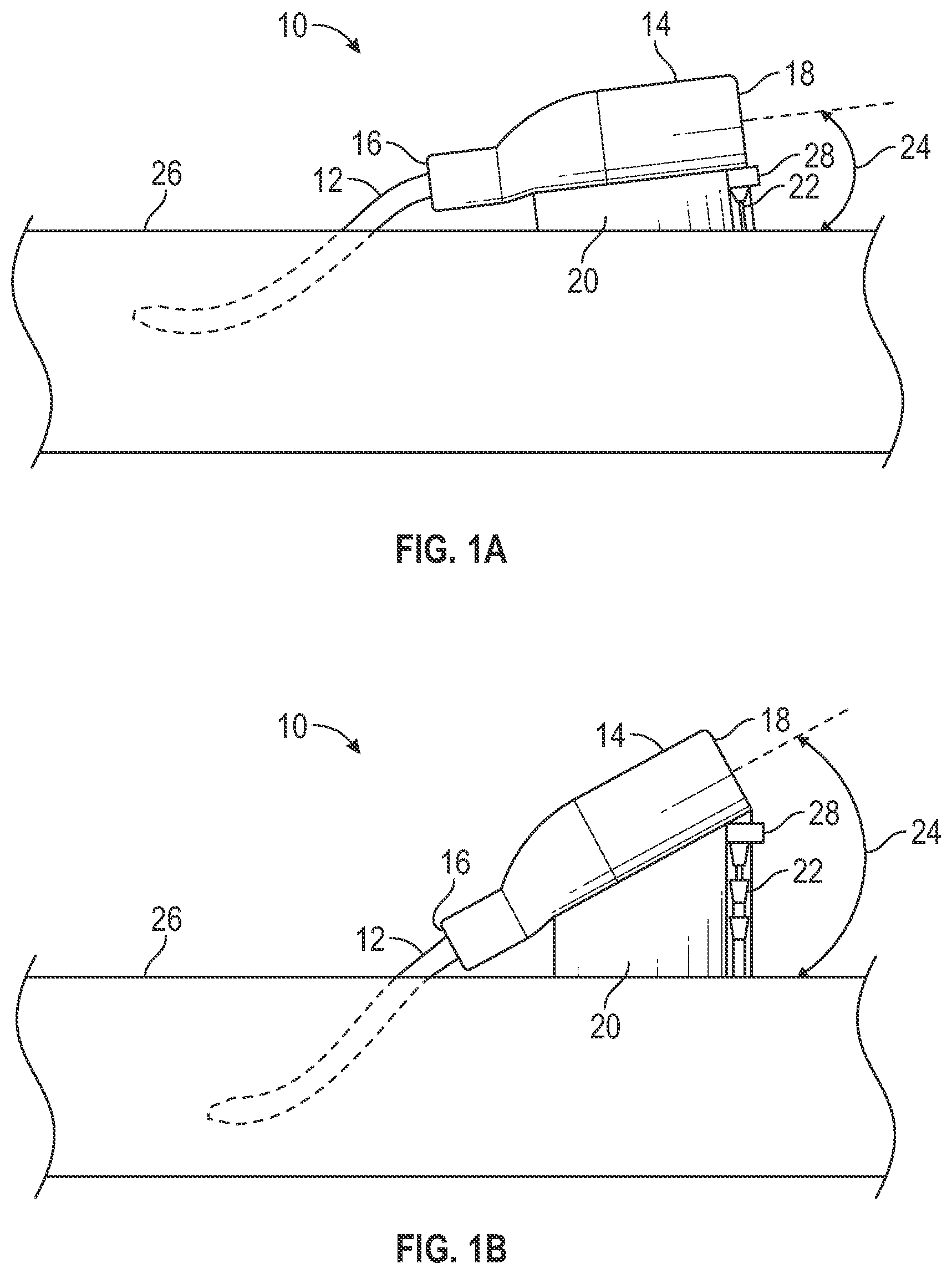 Patent US12403284 — Catheter assembly with angle changing and related methods — Figure 1