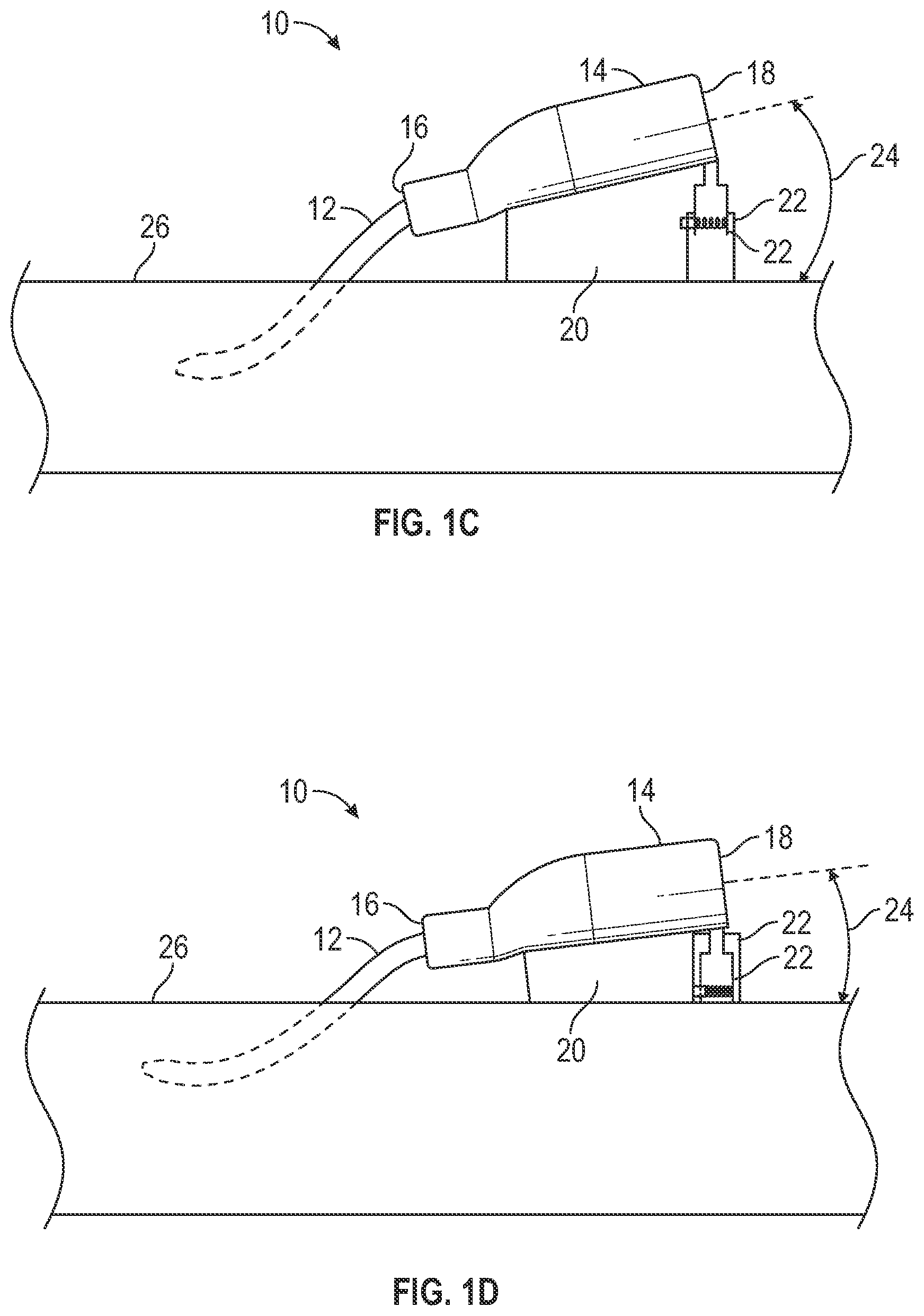 Patent US12403284 Figure 2 – Catheter assembly with angle changing and related methods