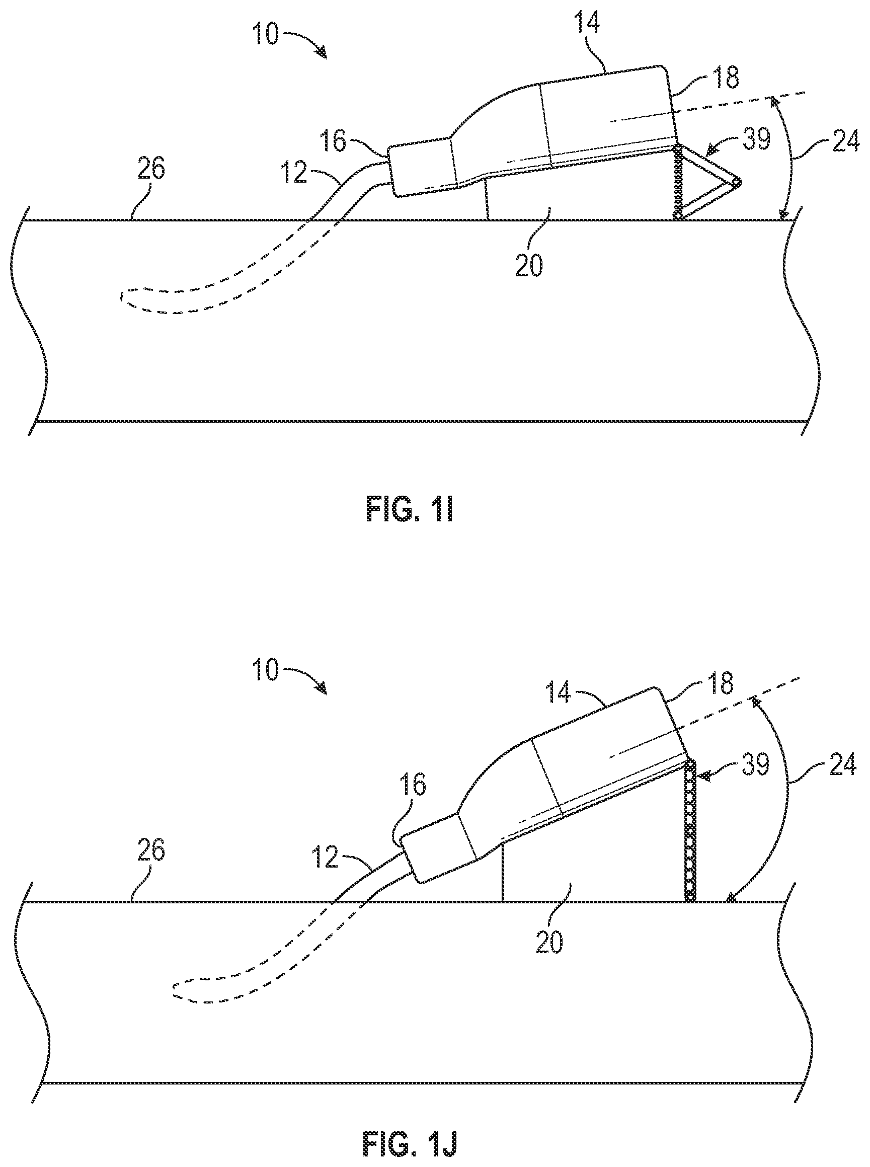 Patent US12403284 Figure 5 – Catheter assembly with angle changing and related methods