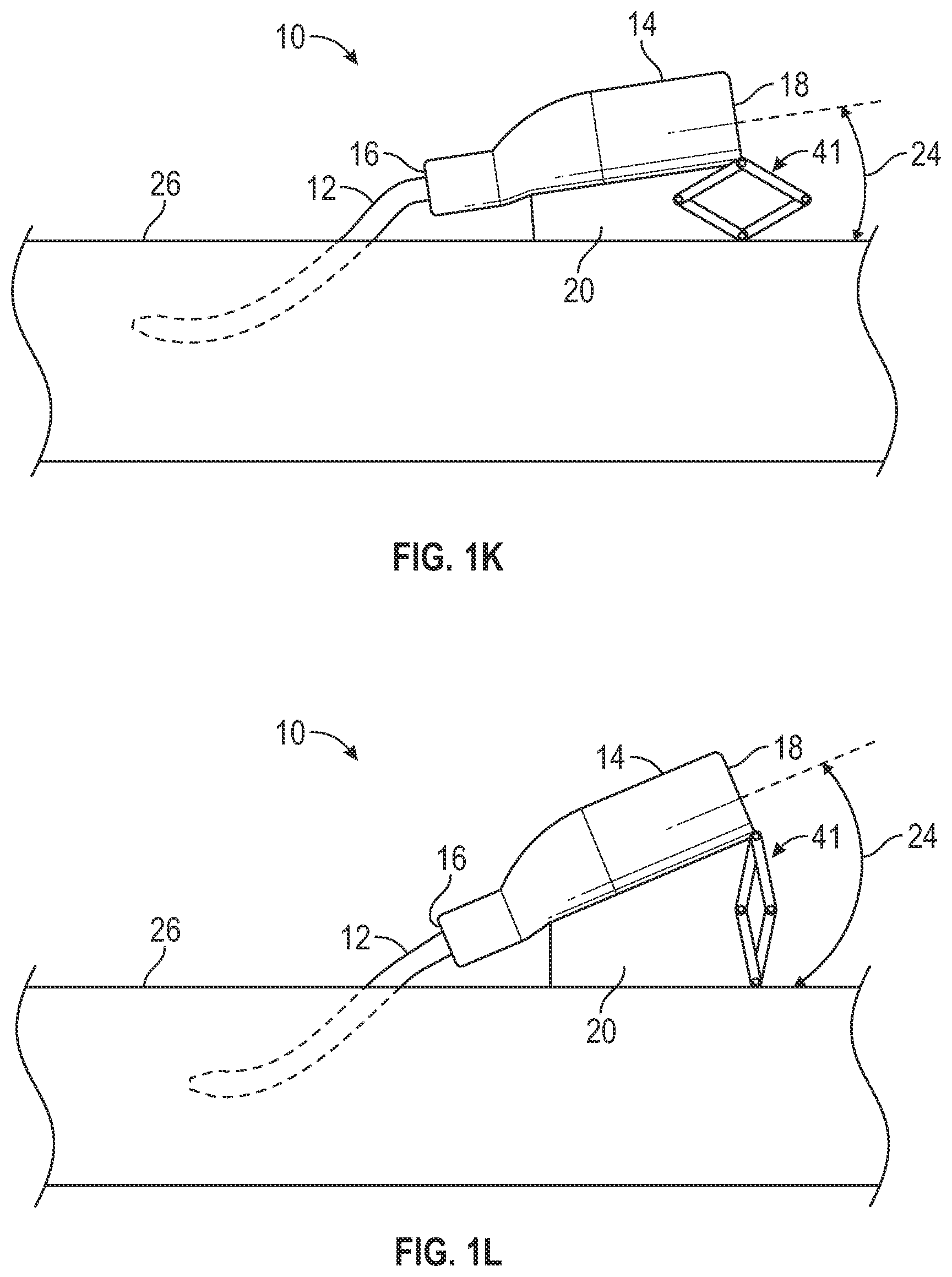 Patent US12403284 Figure 6 – Catheter assembly with angle changing and related methods