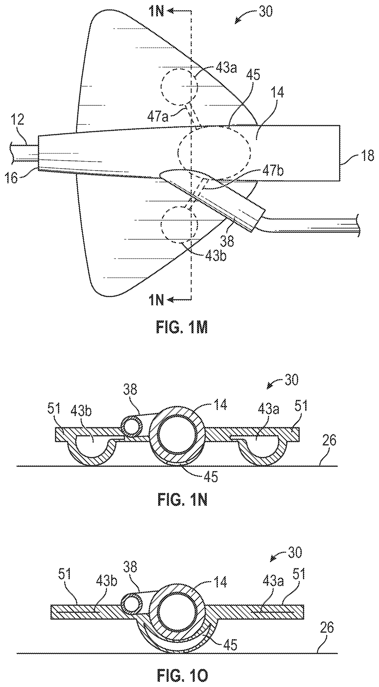Patent US12403284 Figure 7 – Catheter assembly with angle changing and related methods