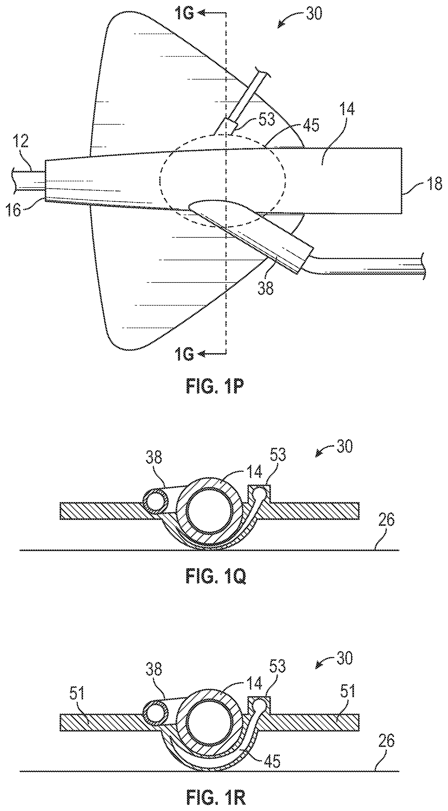 Patent US12403284 Figure 8 – Catheter assembly with angle changing and related methods