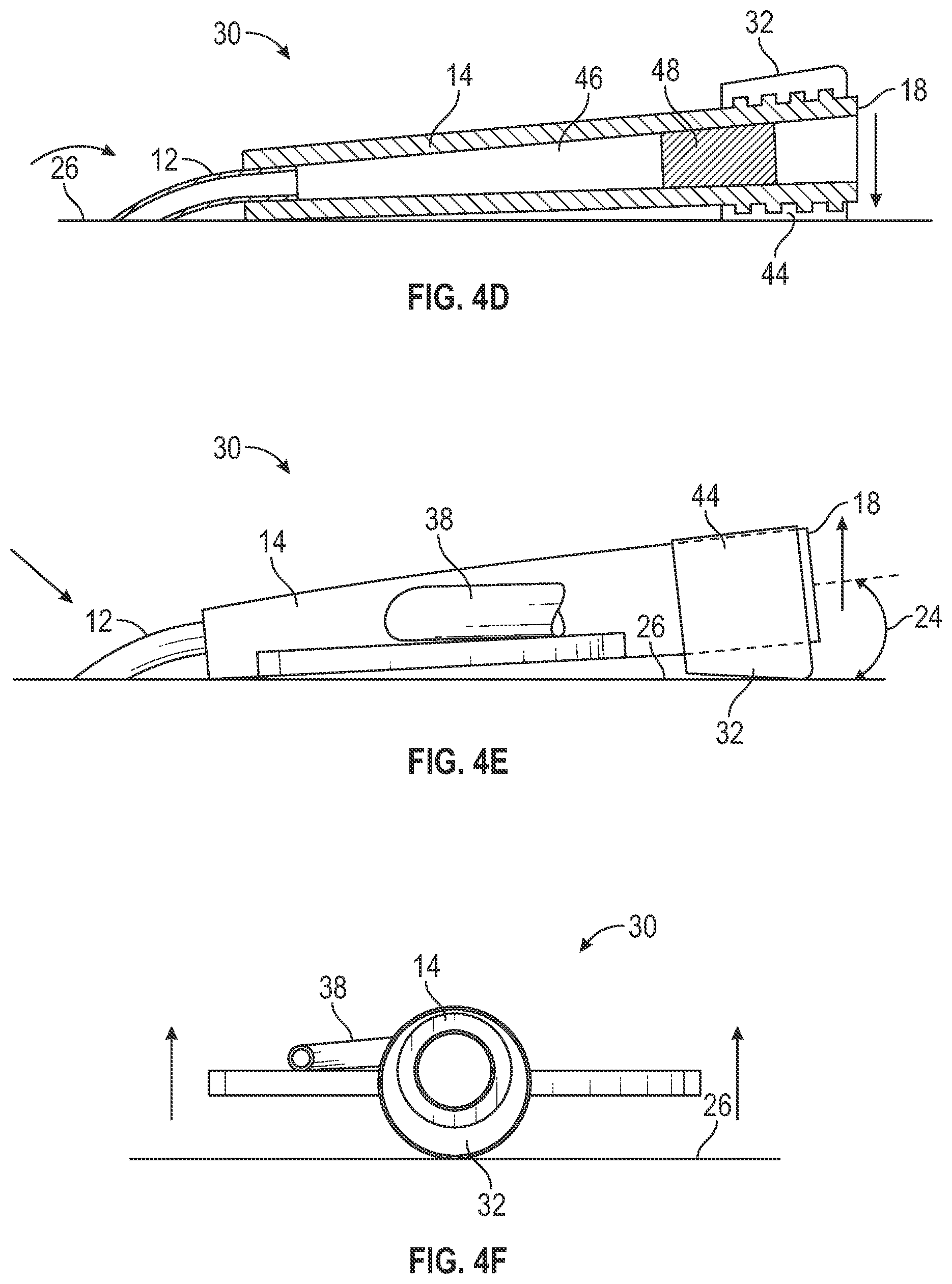 Patent US12403284 Figure 12 – Catheter assembly with angle changing and related methods