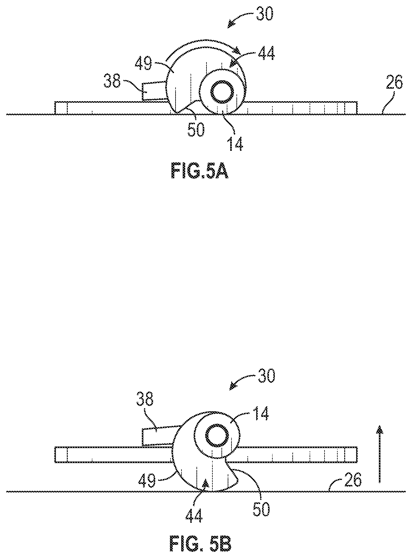 Patent US12403284 Figure 13 – Catheter assembly with angle changing and related methods