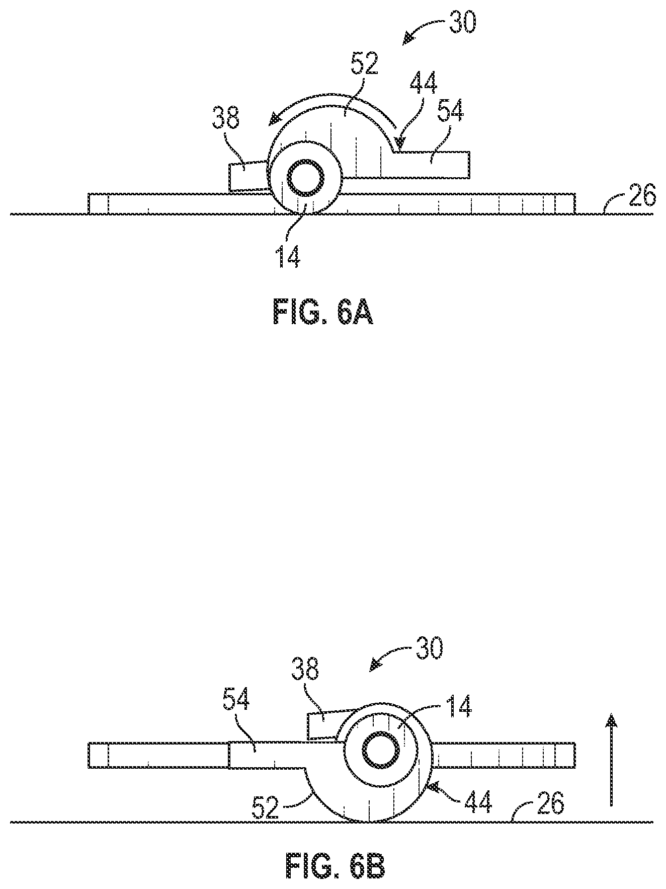 Patent US12403284 Figure 14 – Catheter assembly with angle changing and related methods