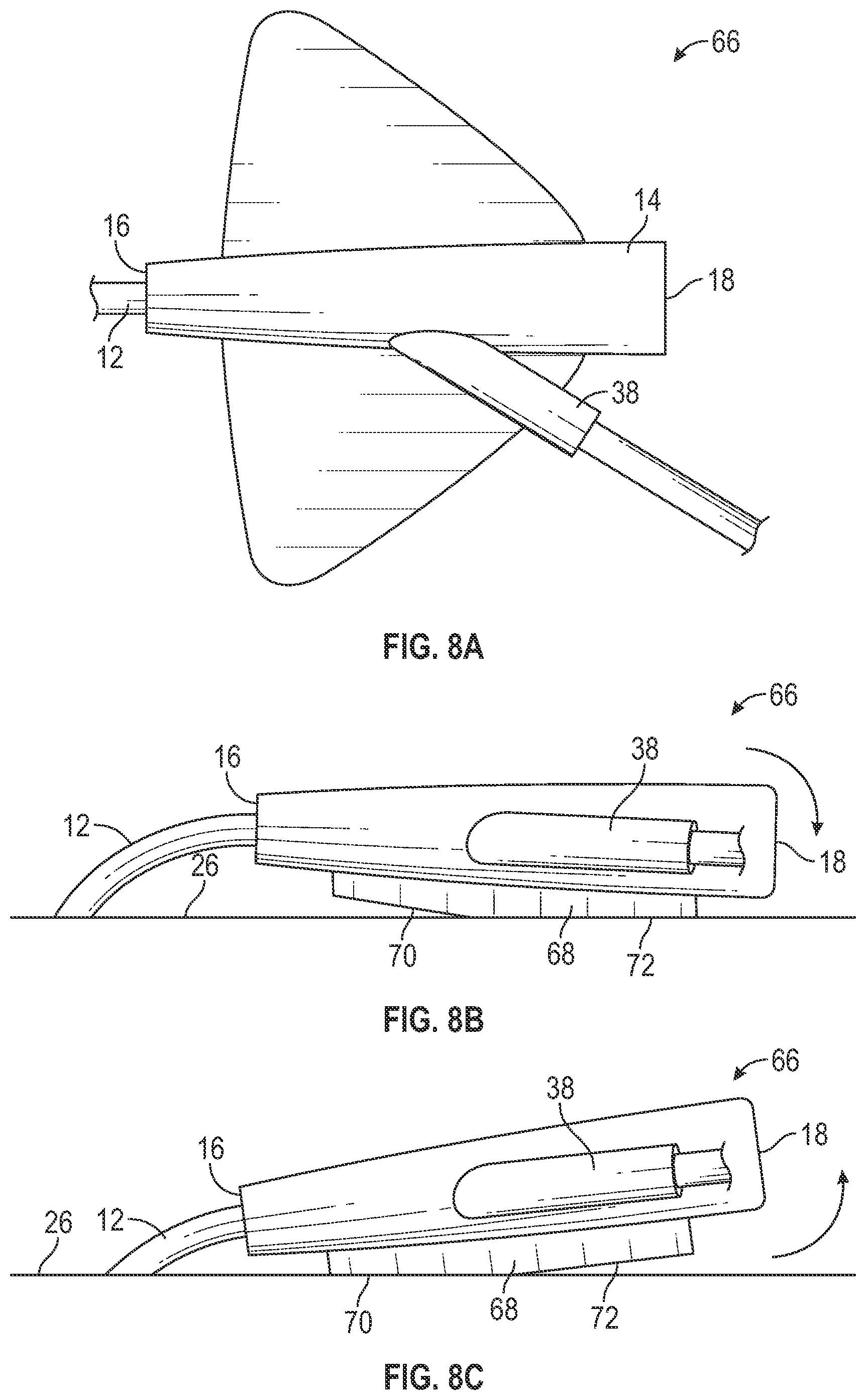 Patent US12403284 Figure 16 – Catheter assembly with angle changing and related methods