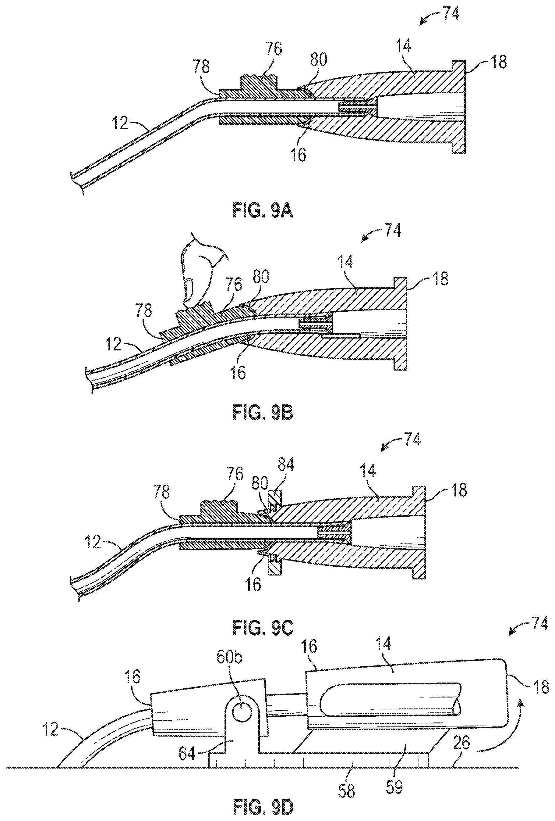 Patent US12403284 Figure 17 – Catheter assembly with angle changing and related methods