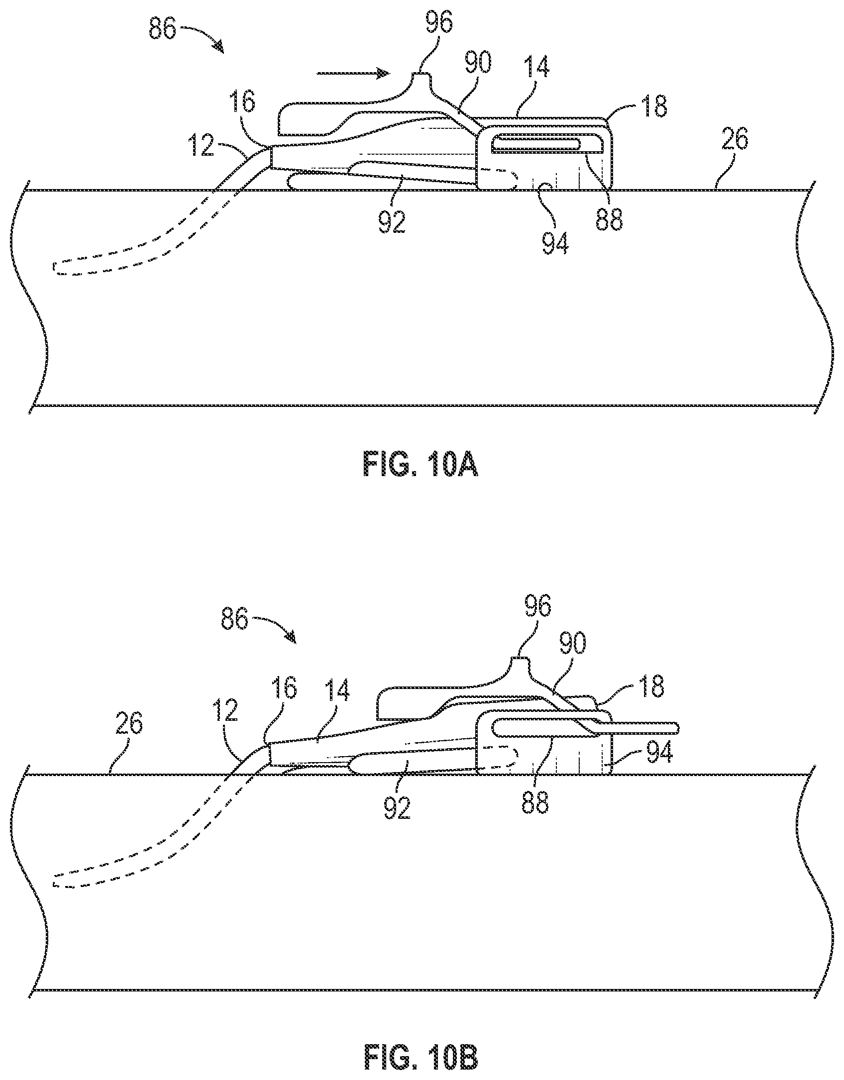 Patent US12403284 Figure 18 – Catheter assembly with angle changing and related methods