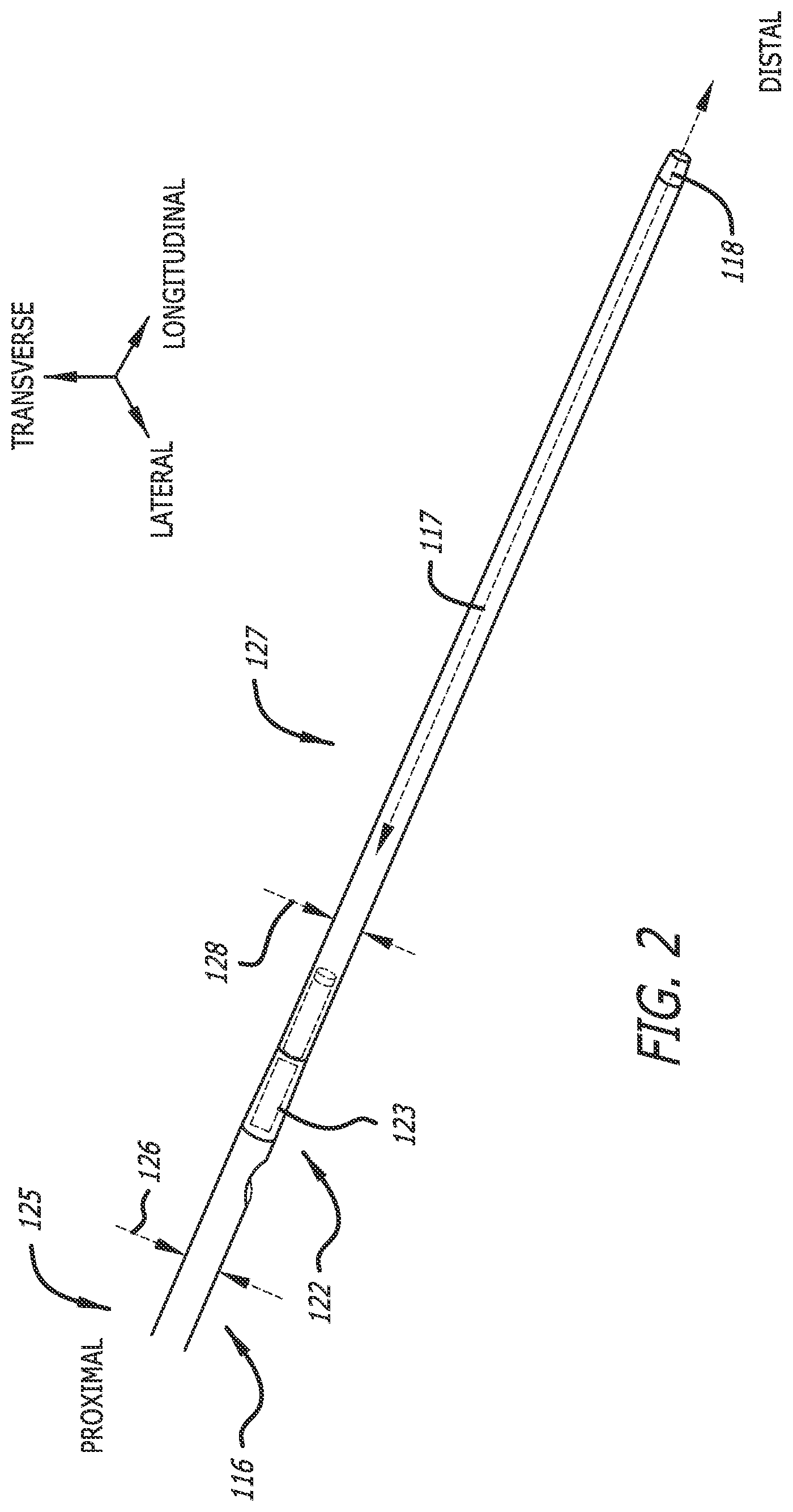 Patent US12403286 Figure 2 – Passive dilation in catheter insertion systems