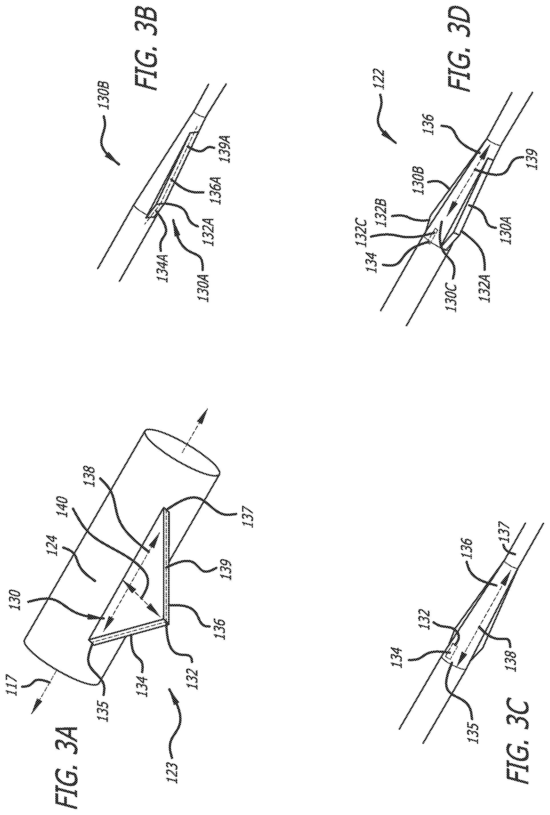 Patent US12403286 Figure 3 – Passive dilation in catheter insertion systems