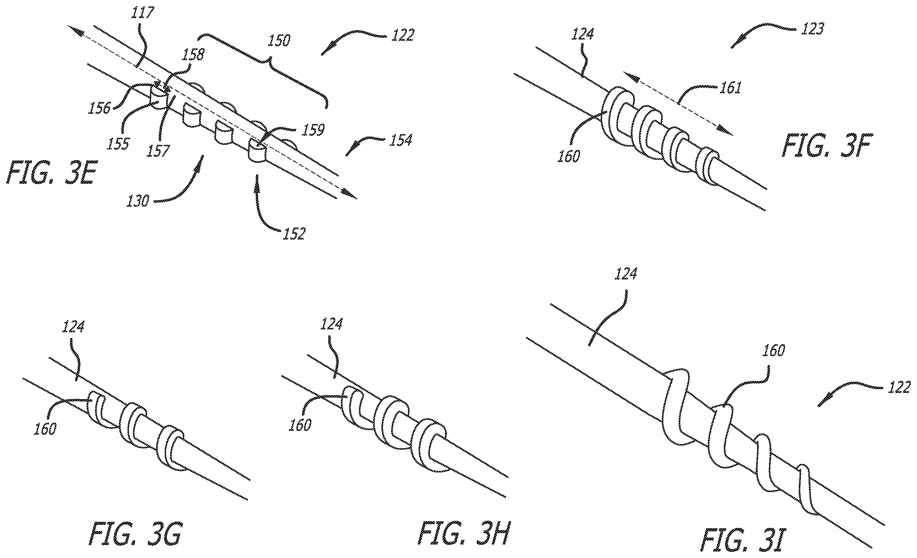 Patent US12403286 Figure 4 – Passive dilation in catheter insertion systems