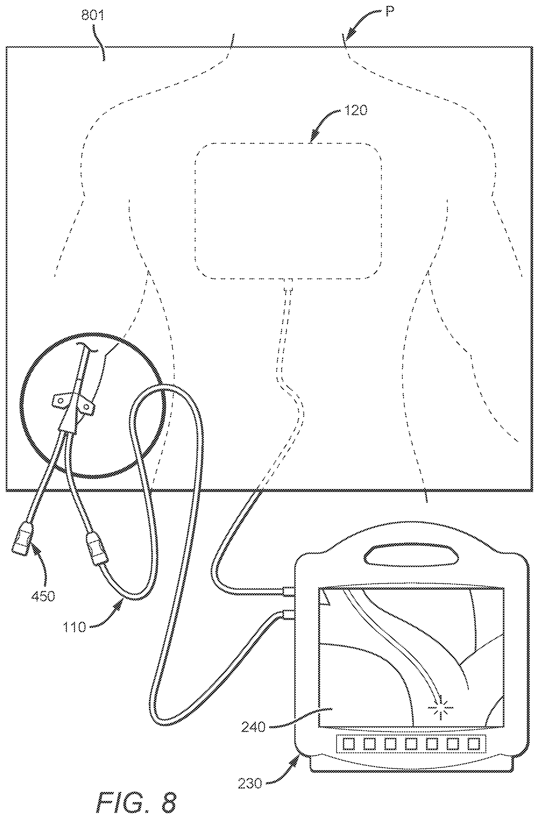Patent US12403288 Figure 5 – Optical tip-tracking systems and methods thereof