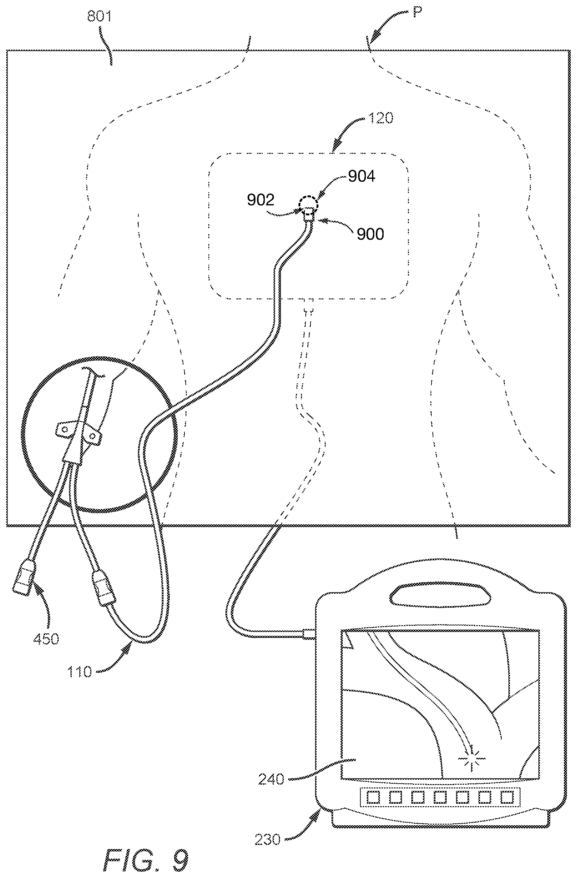 Patent US12403288 Figure 6 – Optical tip-tracking systems and methods thereof