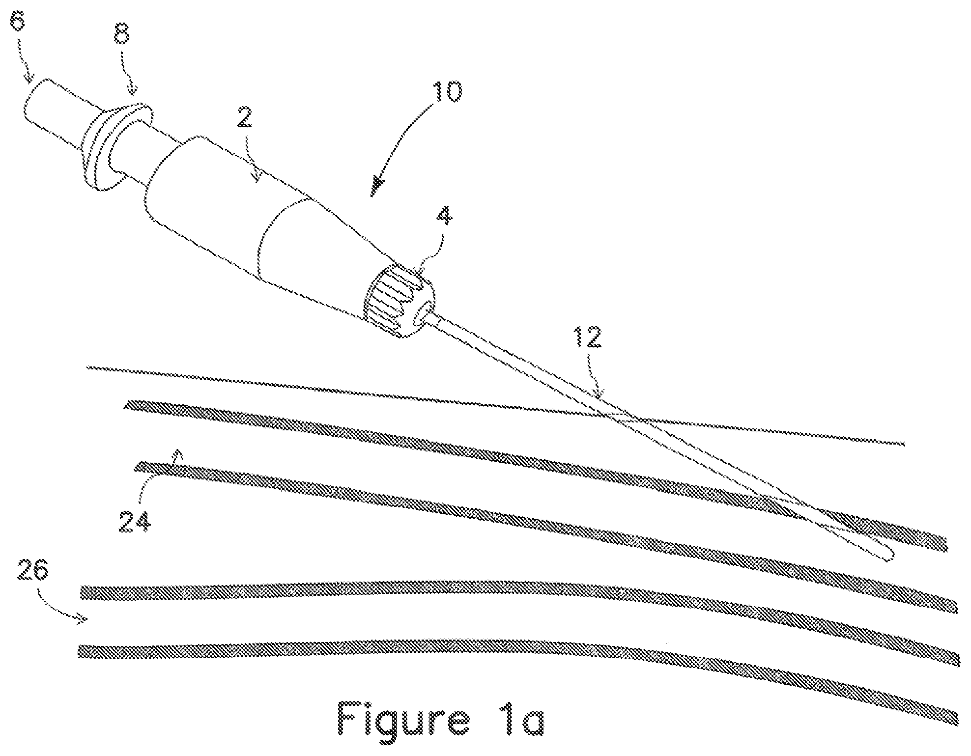 Patent US12403289 Figure 1 – Systems and methods for percutaneous intravascular access and guidewire placement