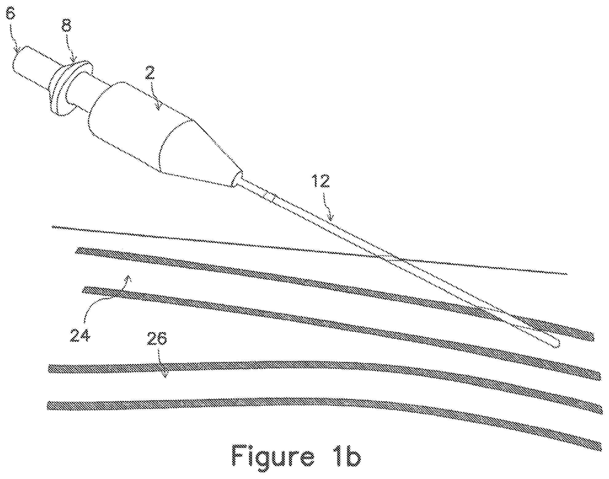 Patent US12403289 Figure 2 – Systems and methods for percutaneous intravascular access and guidewire placement