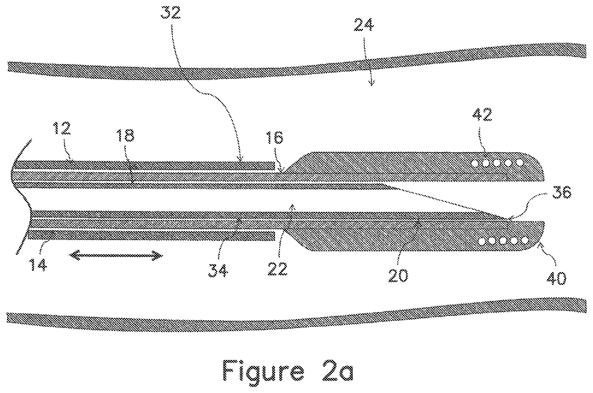 Patent US12403289 Figure 3 – Systems and methods for percutaneous intravascular access and guidewire placement