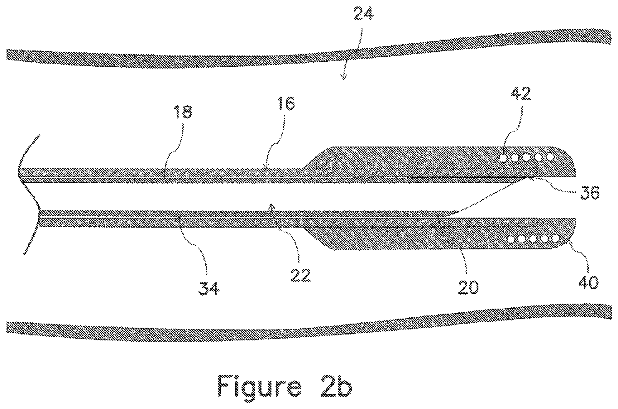 Patent US12403289 Figure 4 – Systems and methods for percutaneous intravascular access and guidewire placement