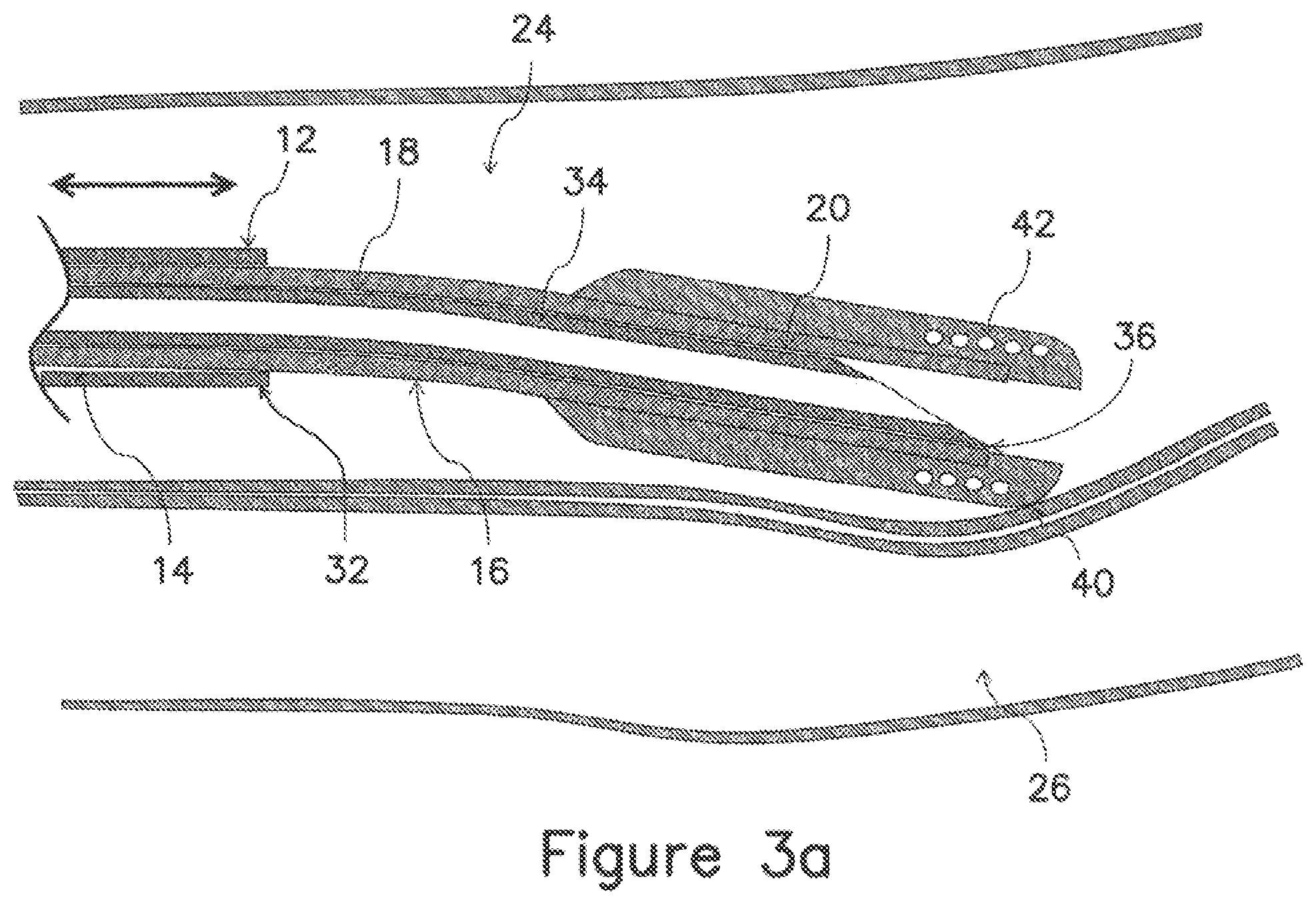 Patent US12403289 Figure 5 – Systems and methods for percutaneous intravascular access and guidewire placement