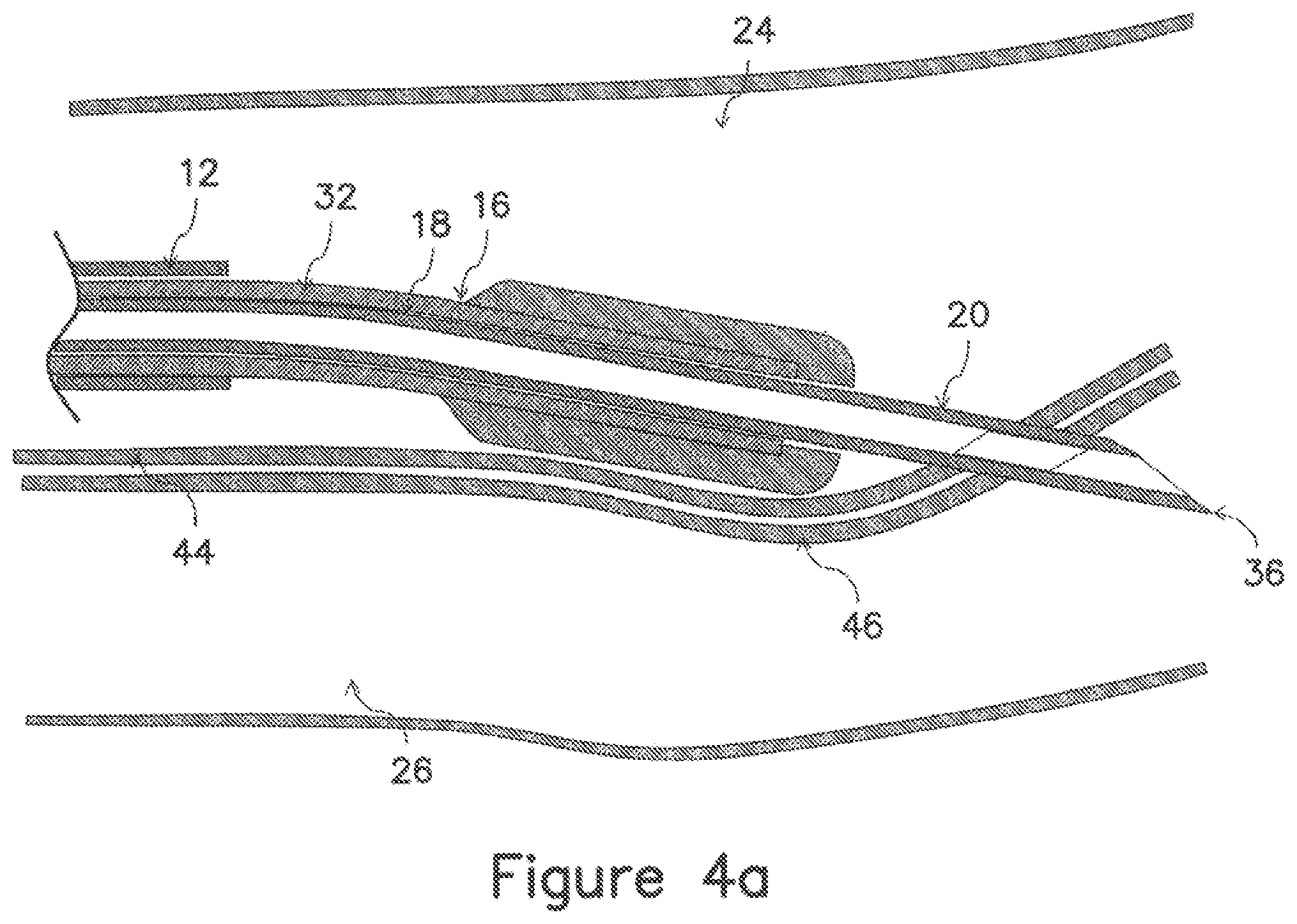 Patent US12403289 Figure 7 – Systems and methods for percutaneous intravascular access and guidewire placement