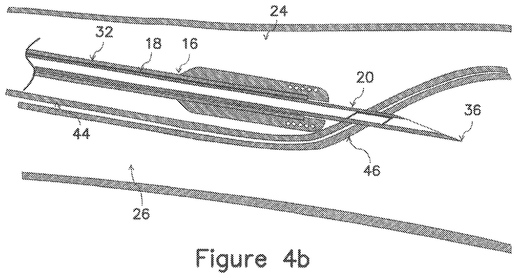 Patent US12403289 Figure 8 – Systems and methods for percutaneous intravascular access and guidewire placement