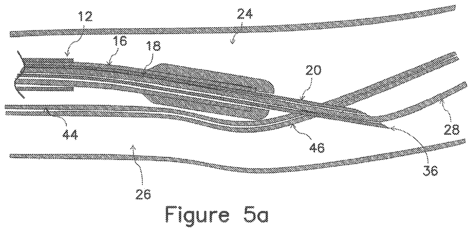 Patent US12403289 Figure 9 – Systems and methods for percutaneous intravascular access and guidewire placement