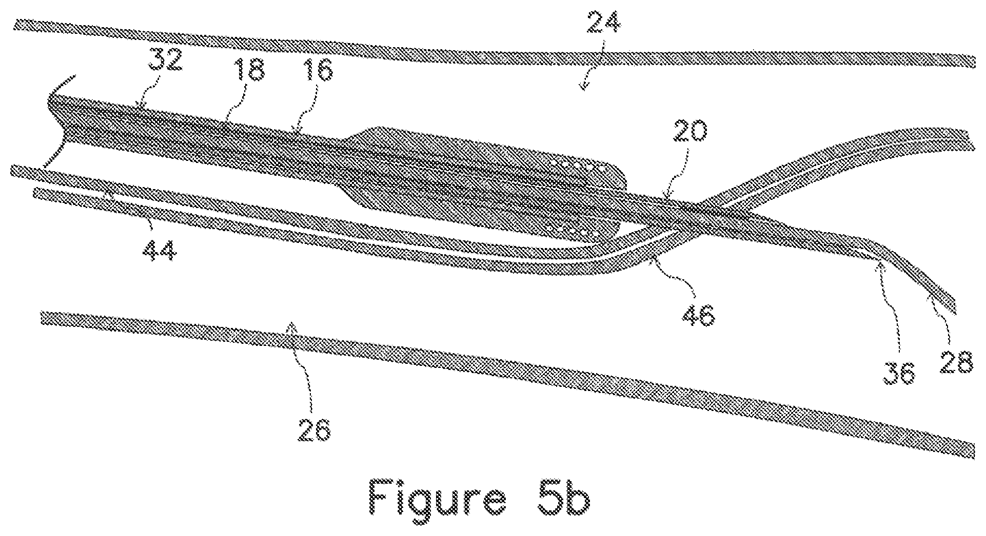 Patent US12403289 Figure 10 – Systems and methods for percutaneous intravascular access and guidewire placement