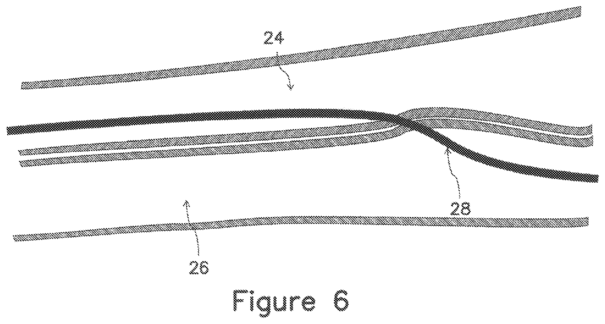 Patent US12403289 Figure 11 – Systems and methods for percutaneous intravascular access and guidewire placement