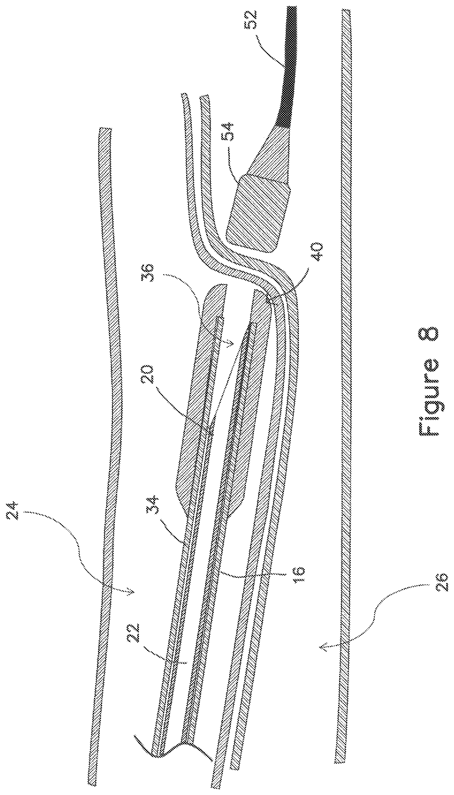Patent US12403289 Figure 13 – Systems and methods for percutaneous intravascular access and guidewire placement