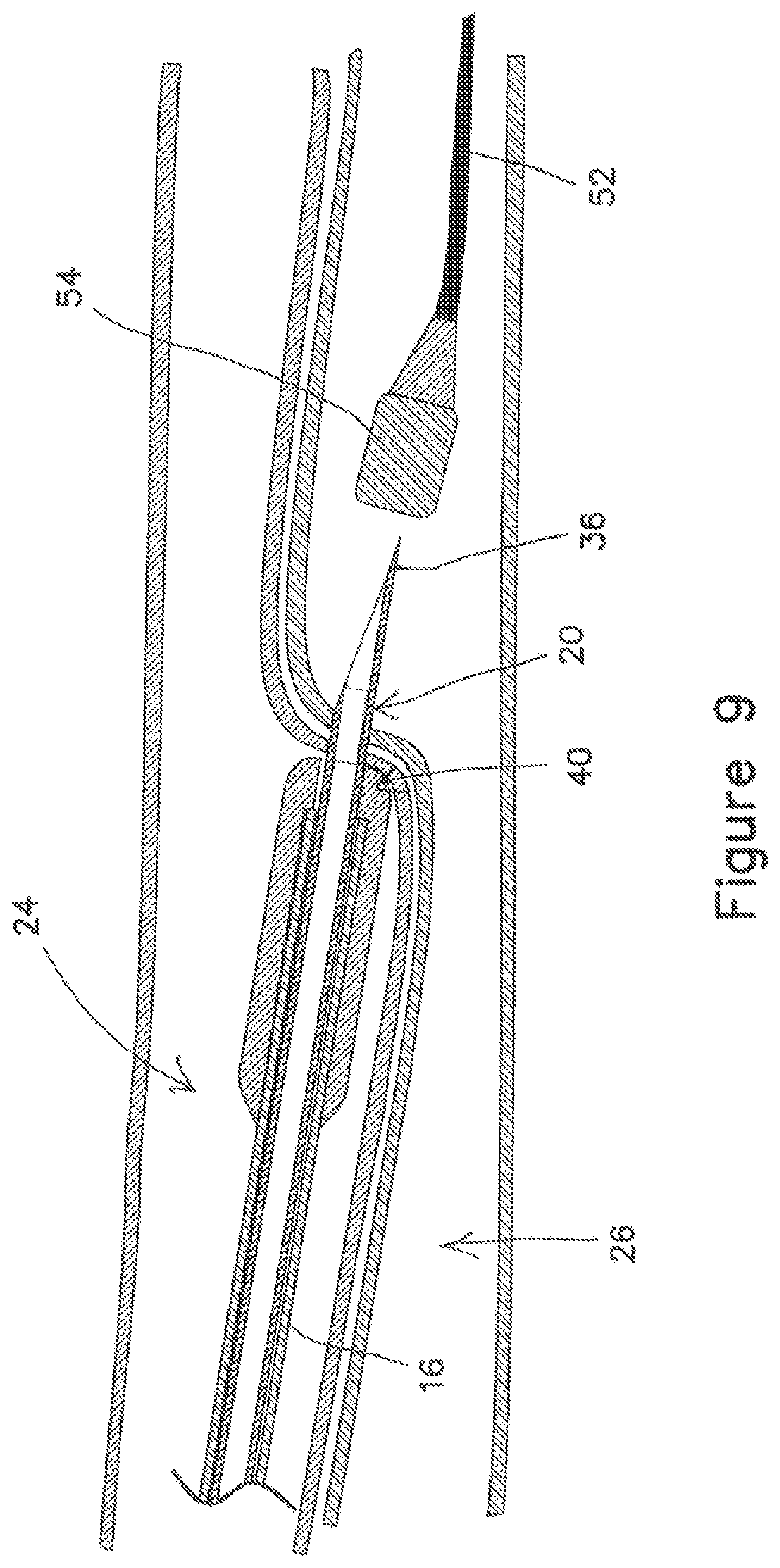 Patent US12403289 Figure 14 – Systems and methods for percutaneous intravascular access and guidewire placement