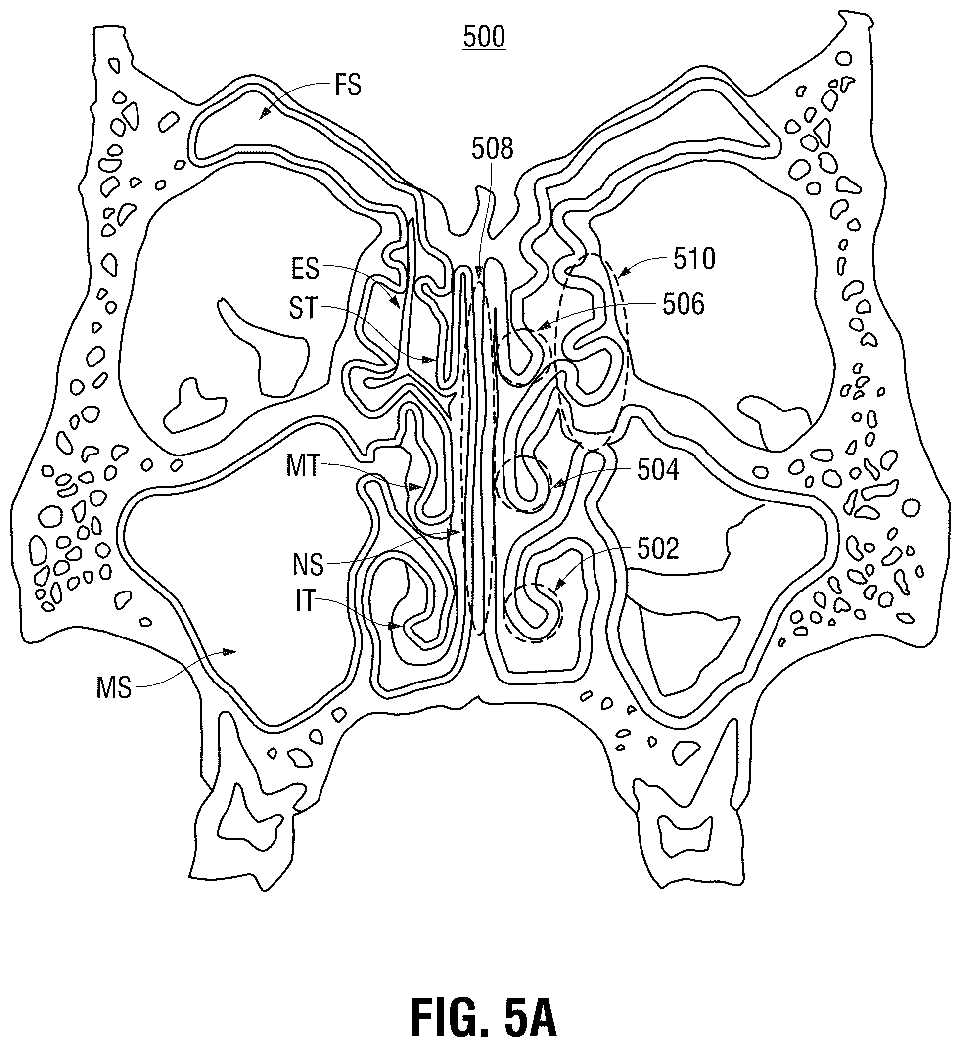 Patent US12403291 Figure 12 – Submucosal bioresorbable drug eluting platform