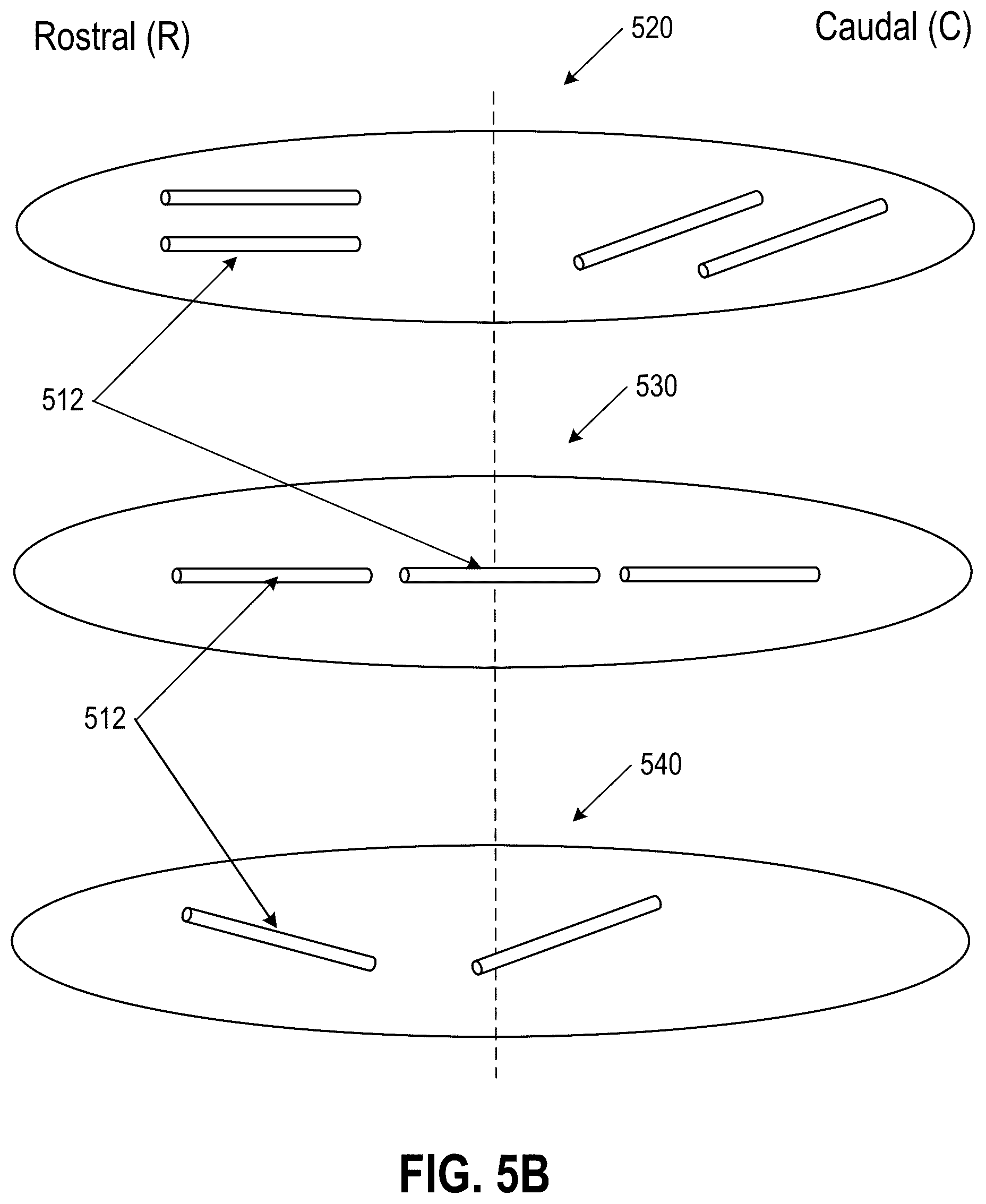 Patent US12403291 Figure 13 – Submucosal bioresorbable drug eluting platform
