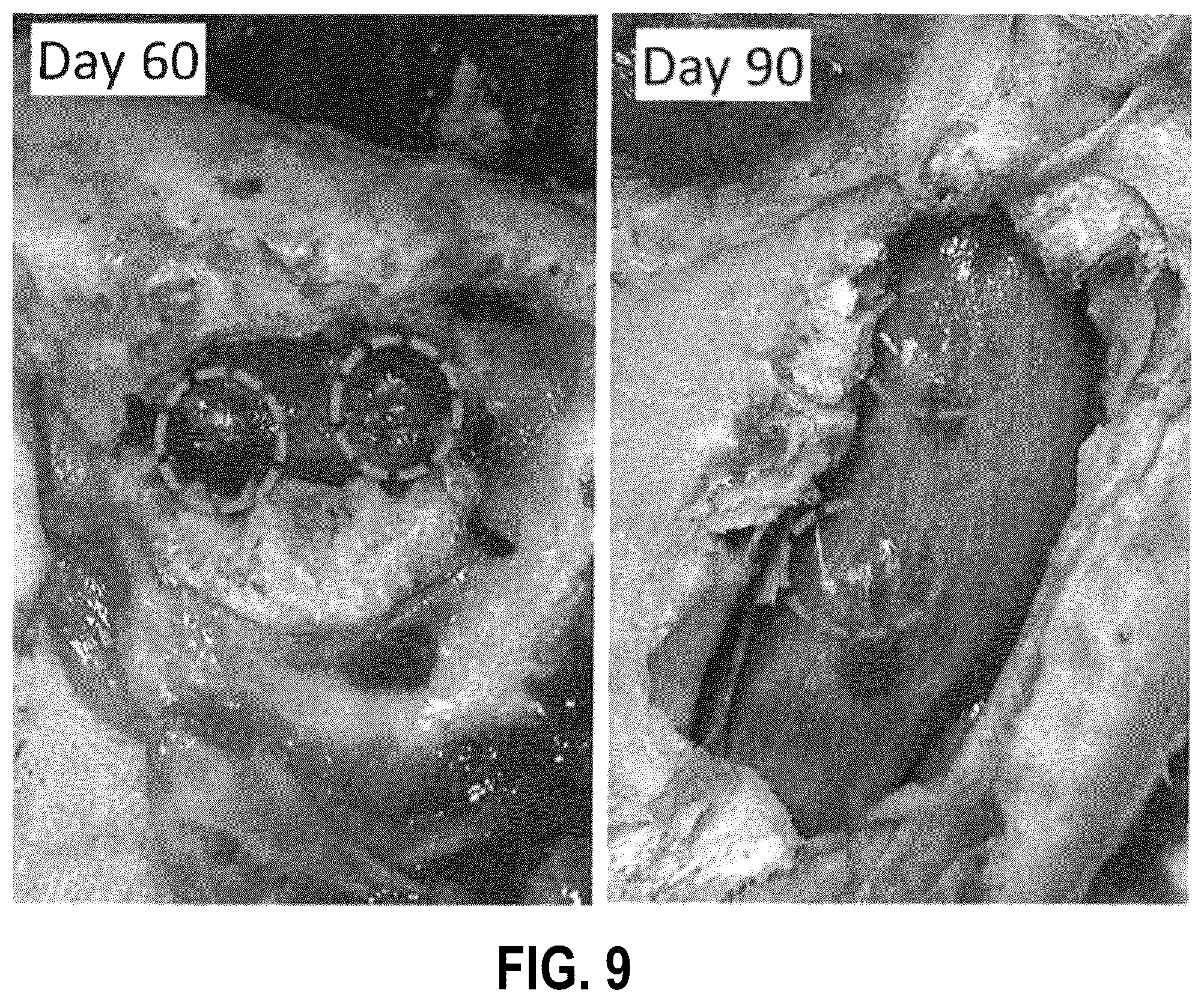 Patent US12403291 Figure 18 – Submucosal bioresorbable drug eluting platform