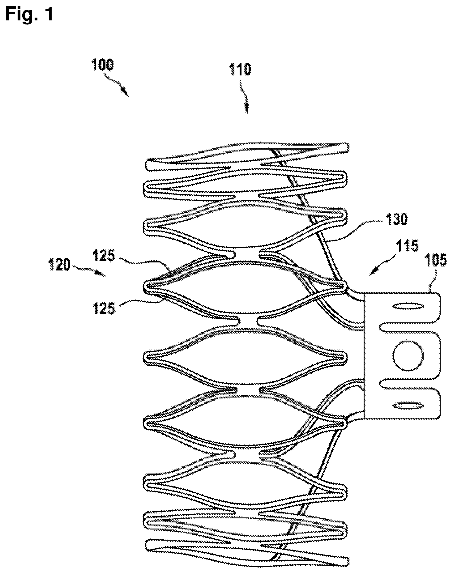 Patent US12403296 Figure 1 – Apparatus for anchoring a ventricular assist system in a blood vessel, operating method, production method for producing an apparatus and ventricular assist system