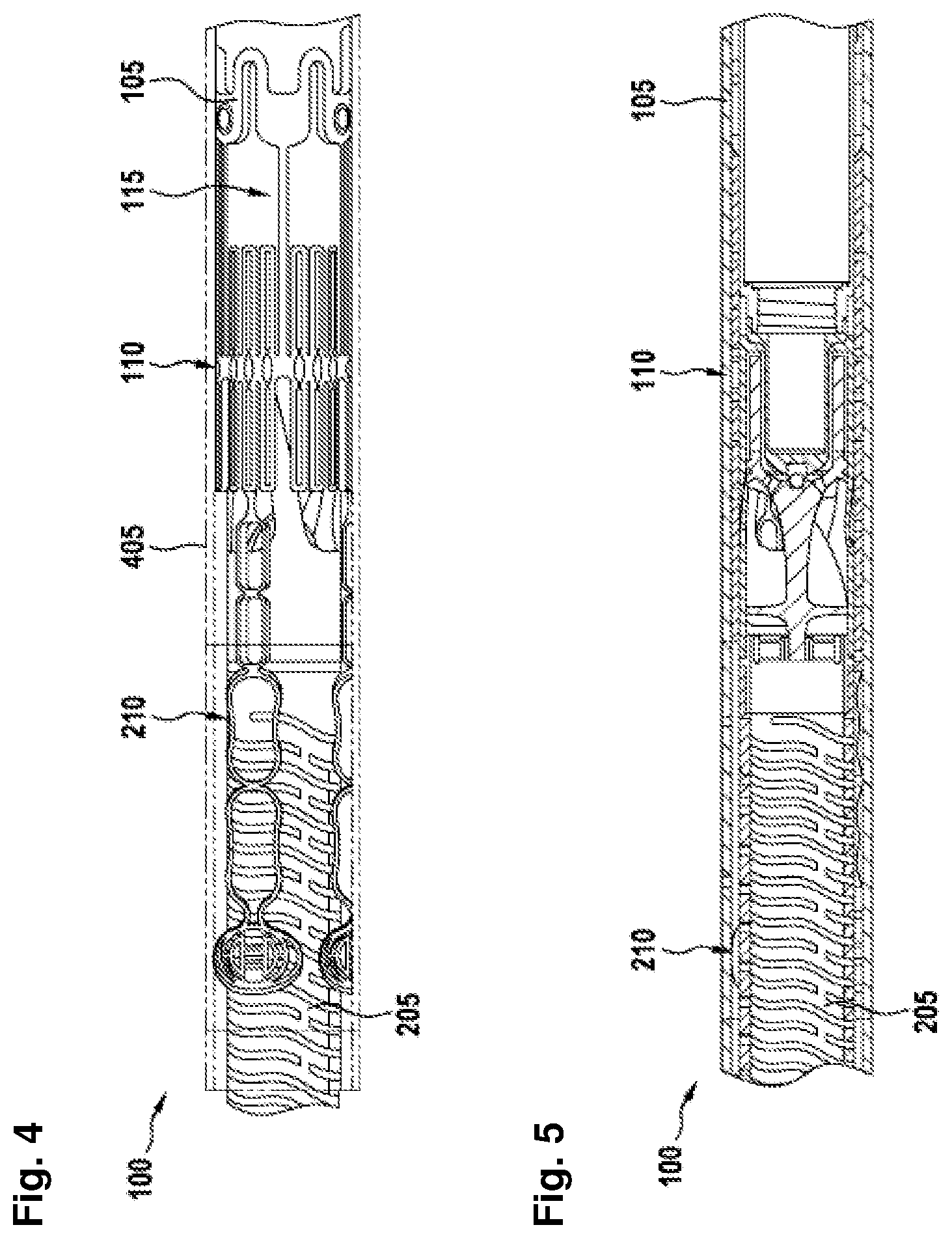 Patent US12403296 Figure 4 – Apparatus for anchoring a ventricular assist system in a blood vessel, operating method, production method for producing an apparatus and ventricular assist system
