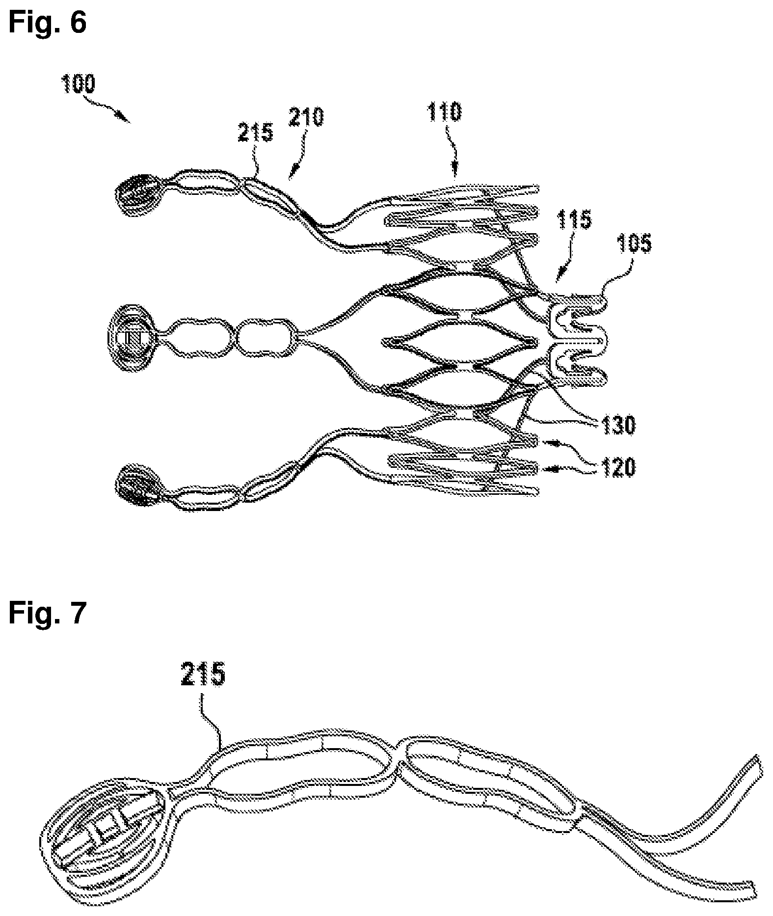 Patent US12403296 Figure 5 – Apparatus for anchoring a ventricular assist system in a blood vessel, operating method, production method for producing an apparatus and ventricular assist system