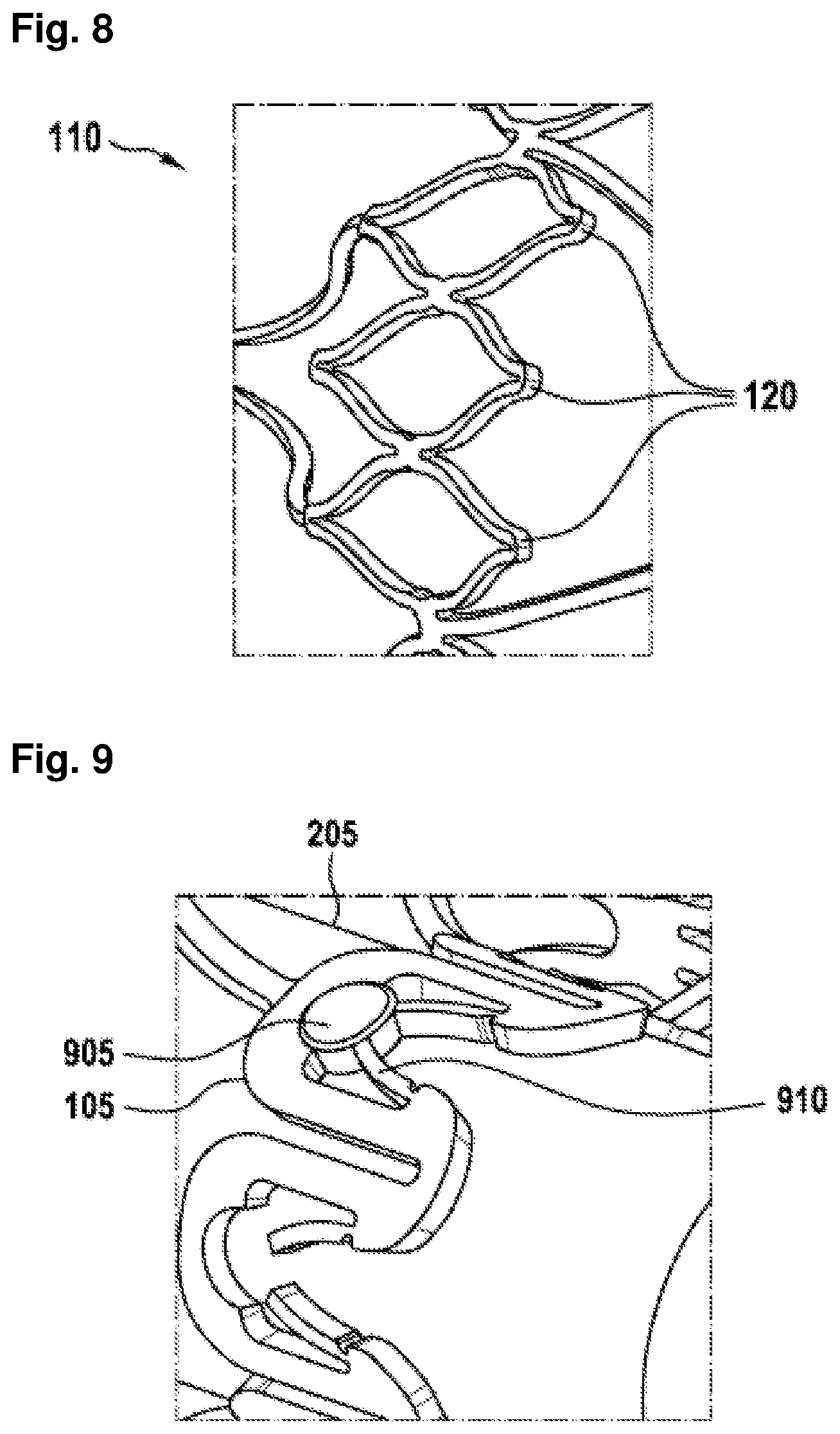 Patent US12403296 Figure 6 – Apparatus for anchoring a ventricular assist system in a blood vessel, operating method, production method for producing an apparatus and ventricular assist system