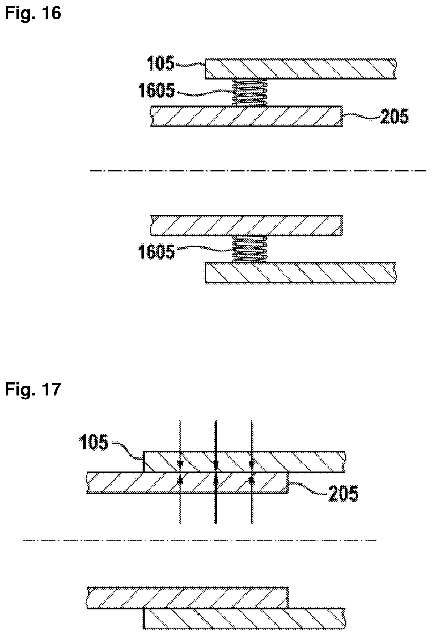 Patent US12403296 Figure 12 – Apparatus for anchoring a ventricular assist system in a blood vessel, operating method, production method for producing an apparatus and ventricular assist system