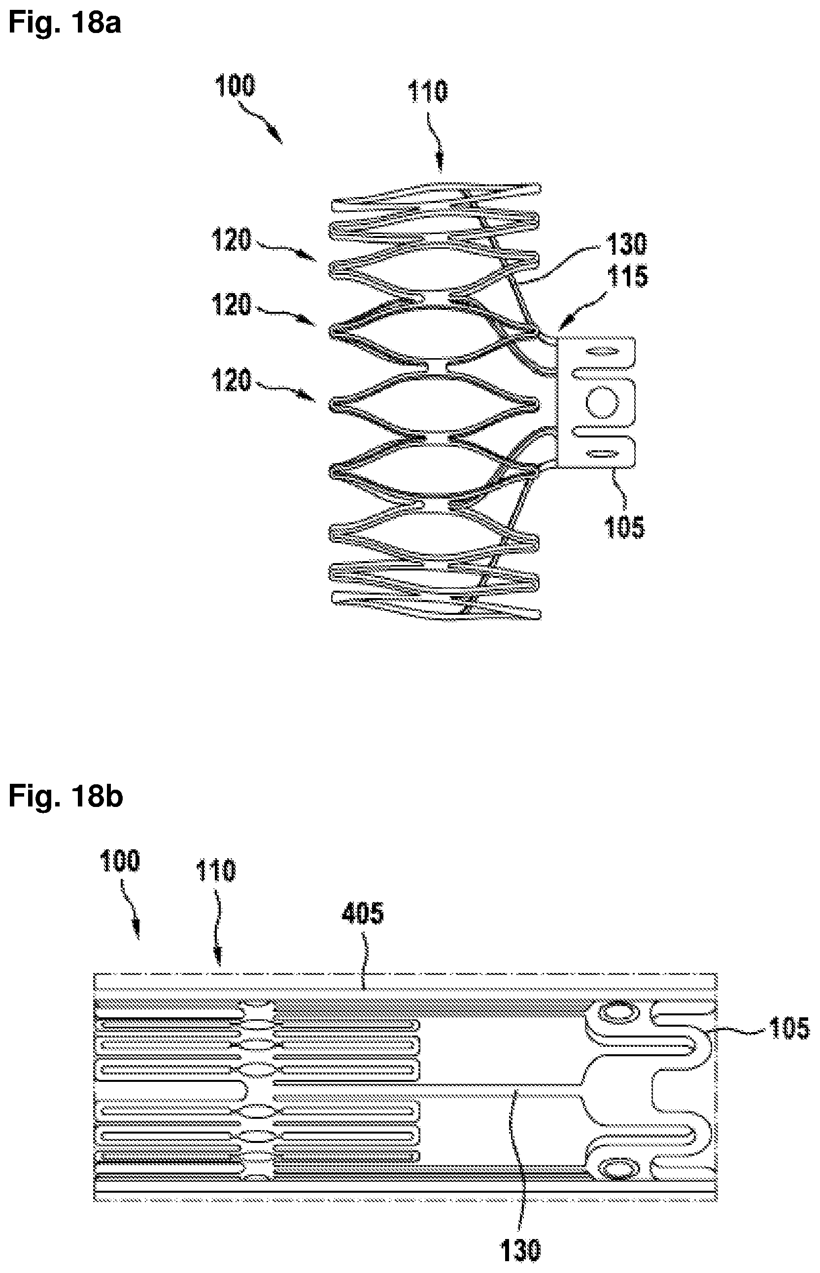 Patent US12403296 Figure 13 – Apparatus for anchoring a ventricular assist system in a blood vessel, operating method, production method for producing an apparatus and ventricular assist system