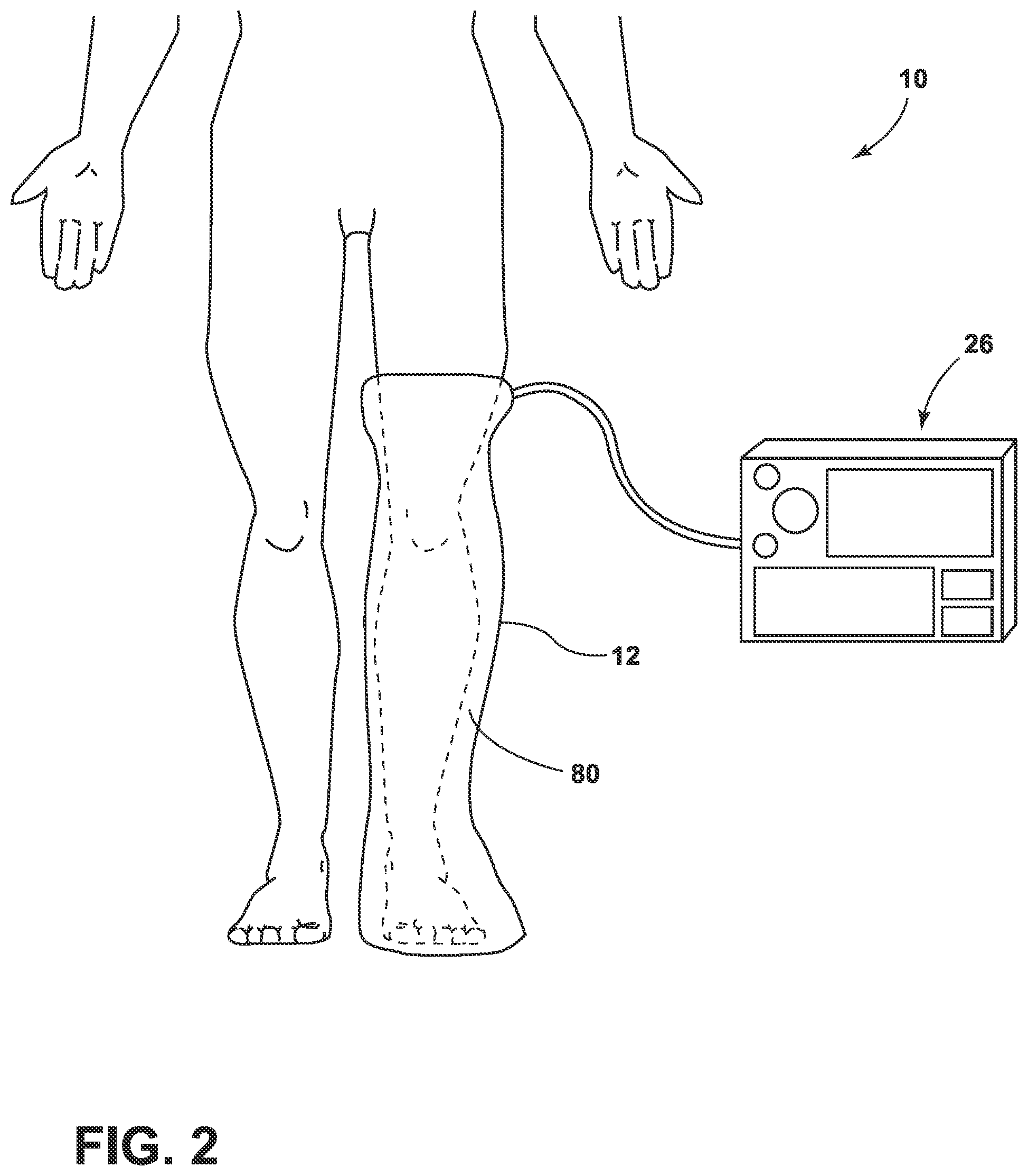 Patent US12403299 Figure 4 – Apparatuses, systems, and methods for the treatment of damaged tissue