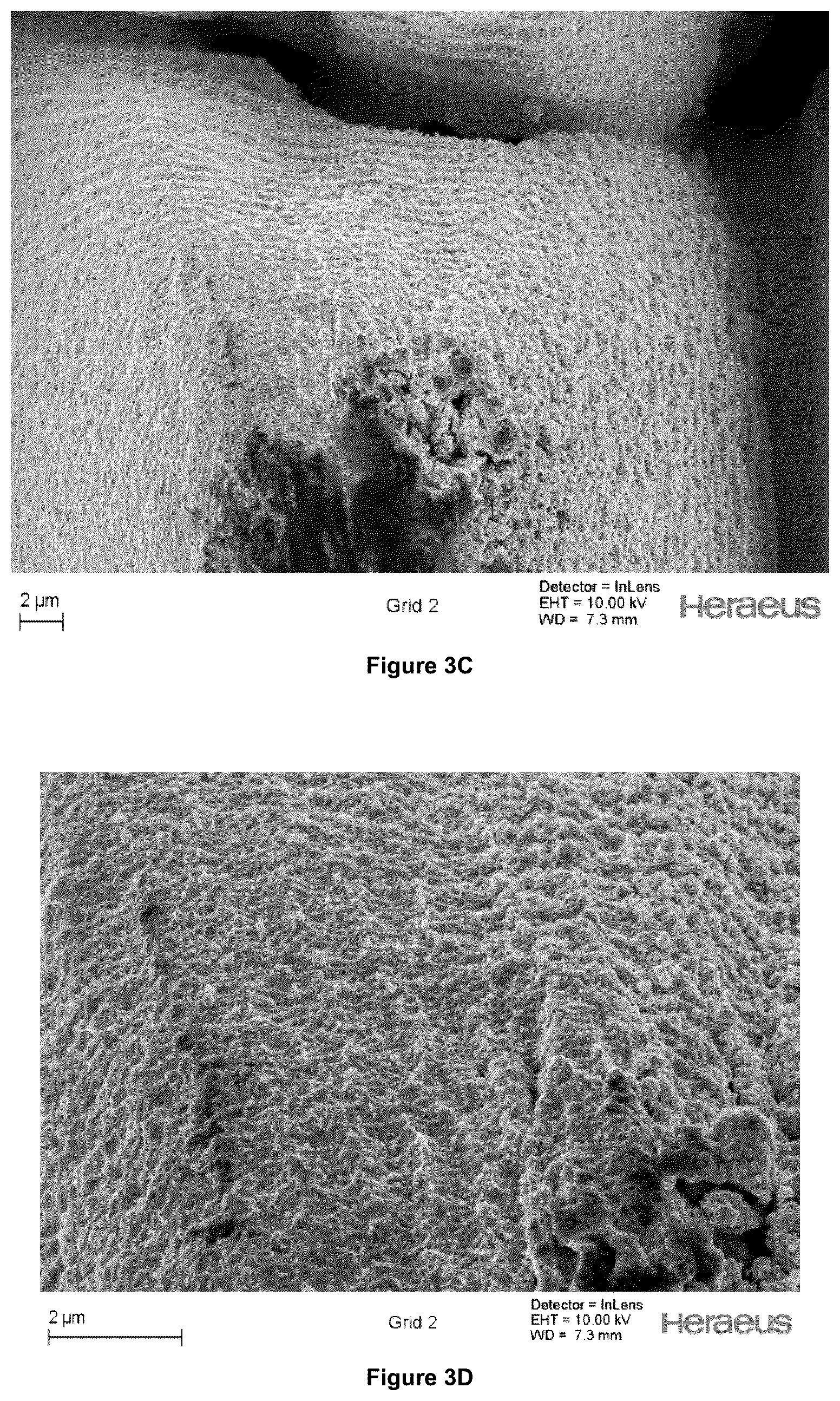 Patent US12403300 Figure 4 – Electrode for a medical device