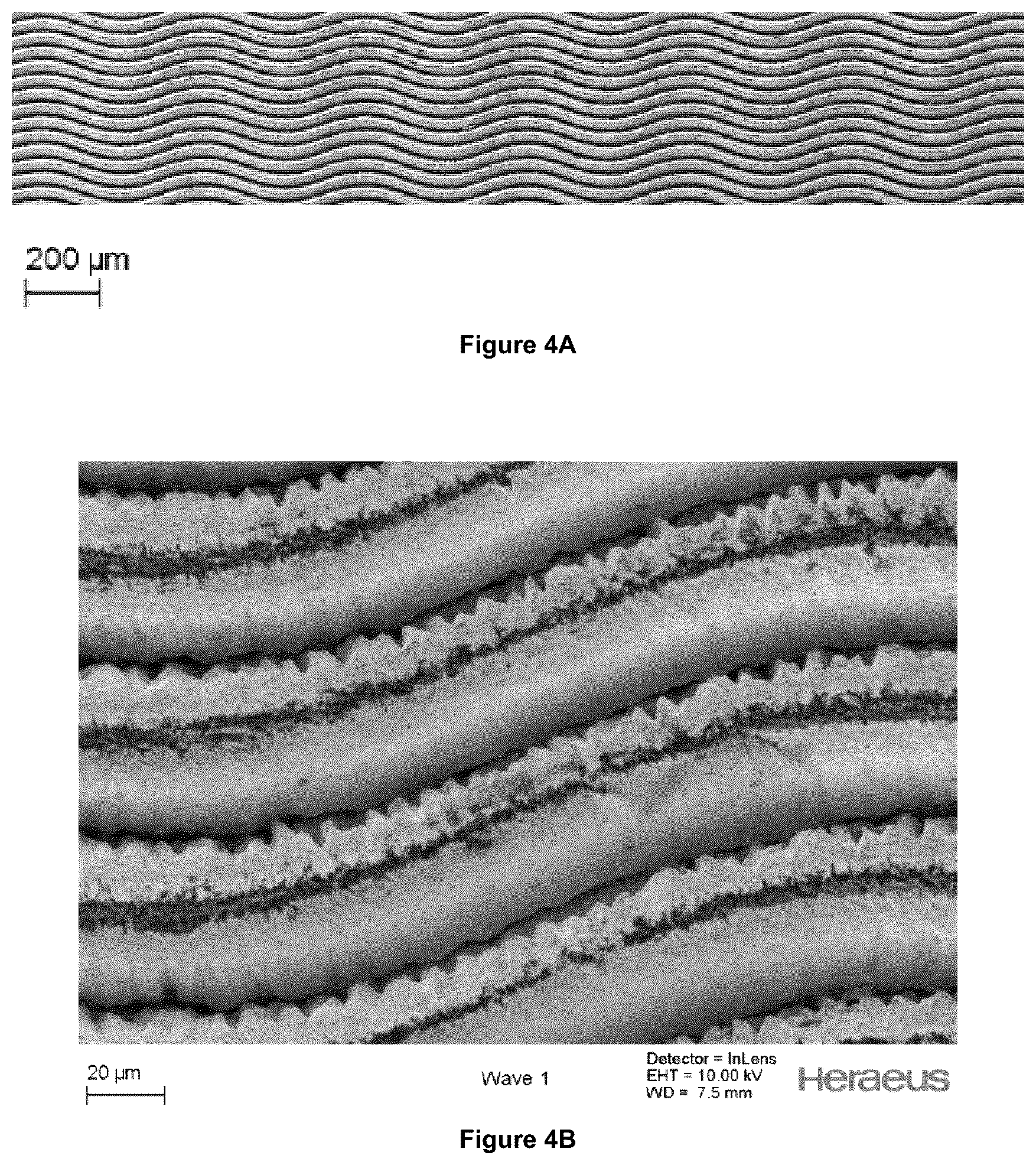 Patent US12403300 Figure 5 – Electrode for a medical device