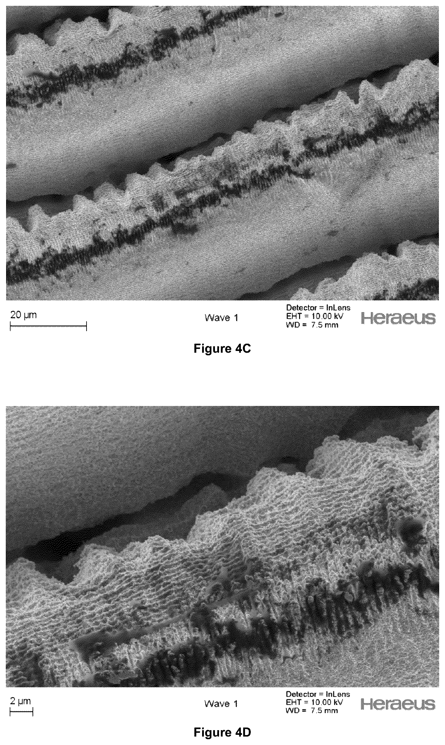 Patent US12403300 Figure 6 – Electrode for a medical device