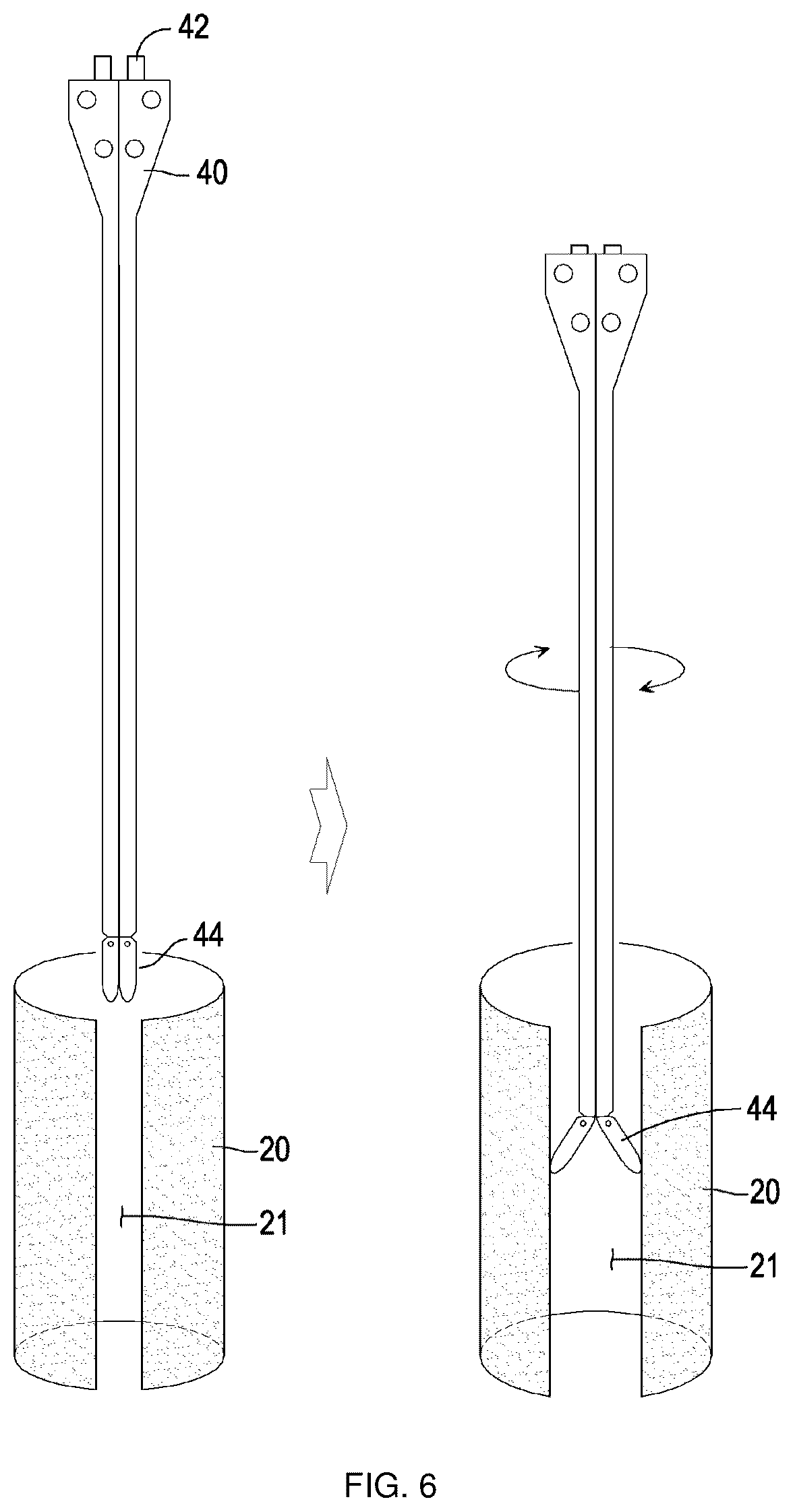 Patent US12403301 Figure 6 – Lead for applying electrical stimulation to body organ, and electrode system using same