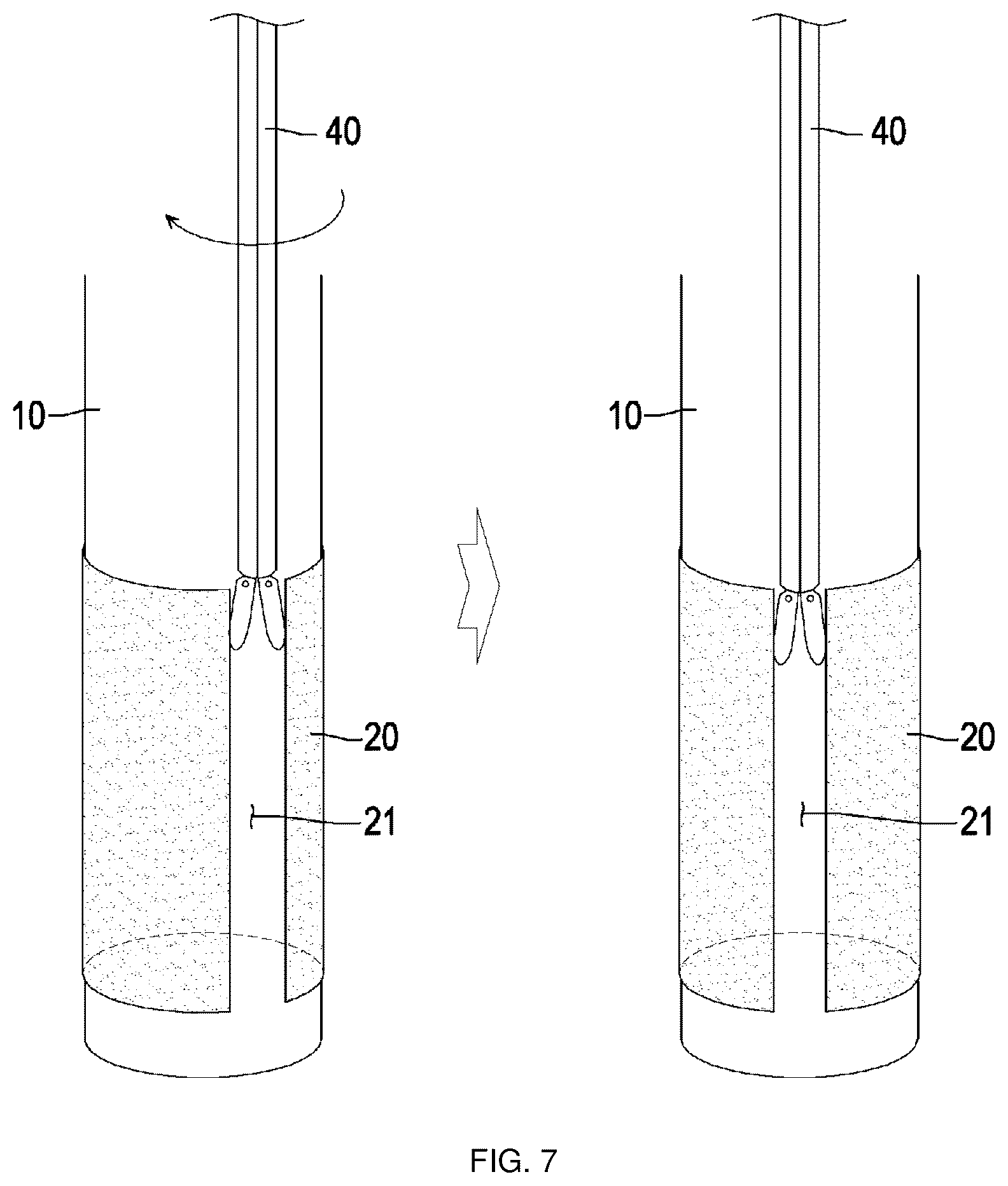 Patent US12403301 Figure 7 – Lead for applying electrical stimulation to body organ, and electrode system using same