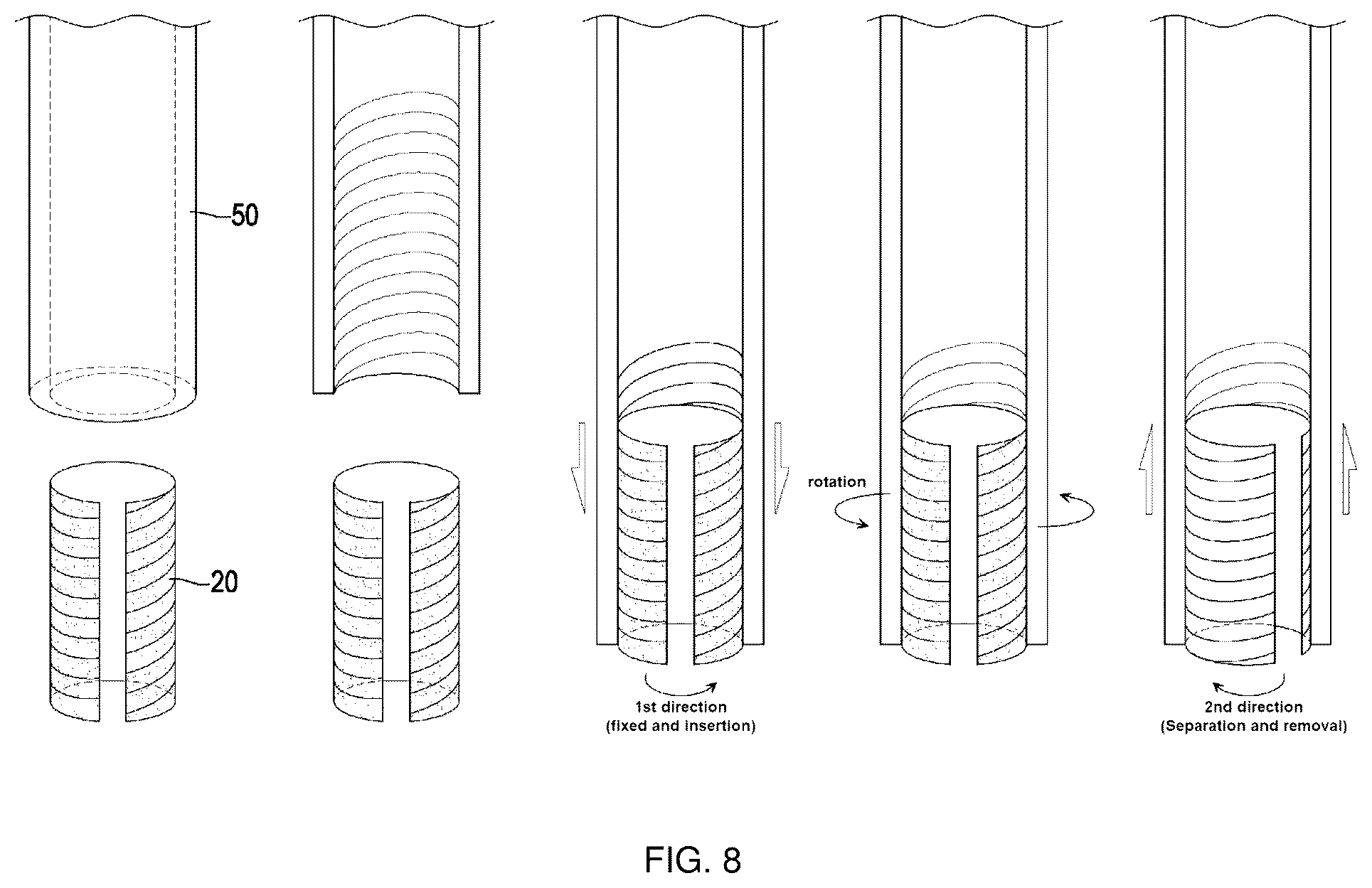 Patent US12403301 Figure 8 – Lead for applying electrical stimulation to body organ, and electrode system using same