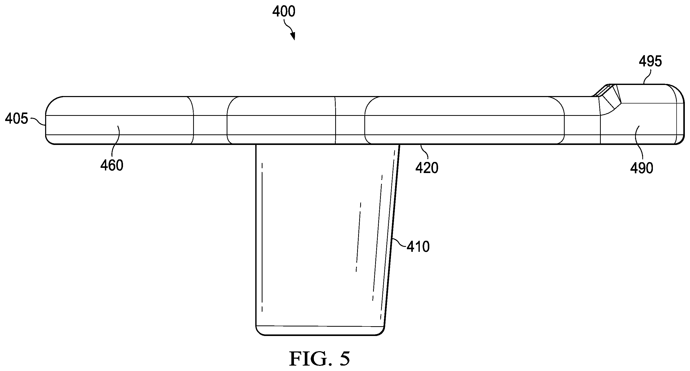 Patent US12403302 Figure 5 – Methods and apparatus for a lead fixation device