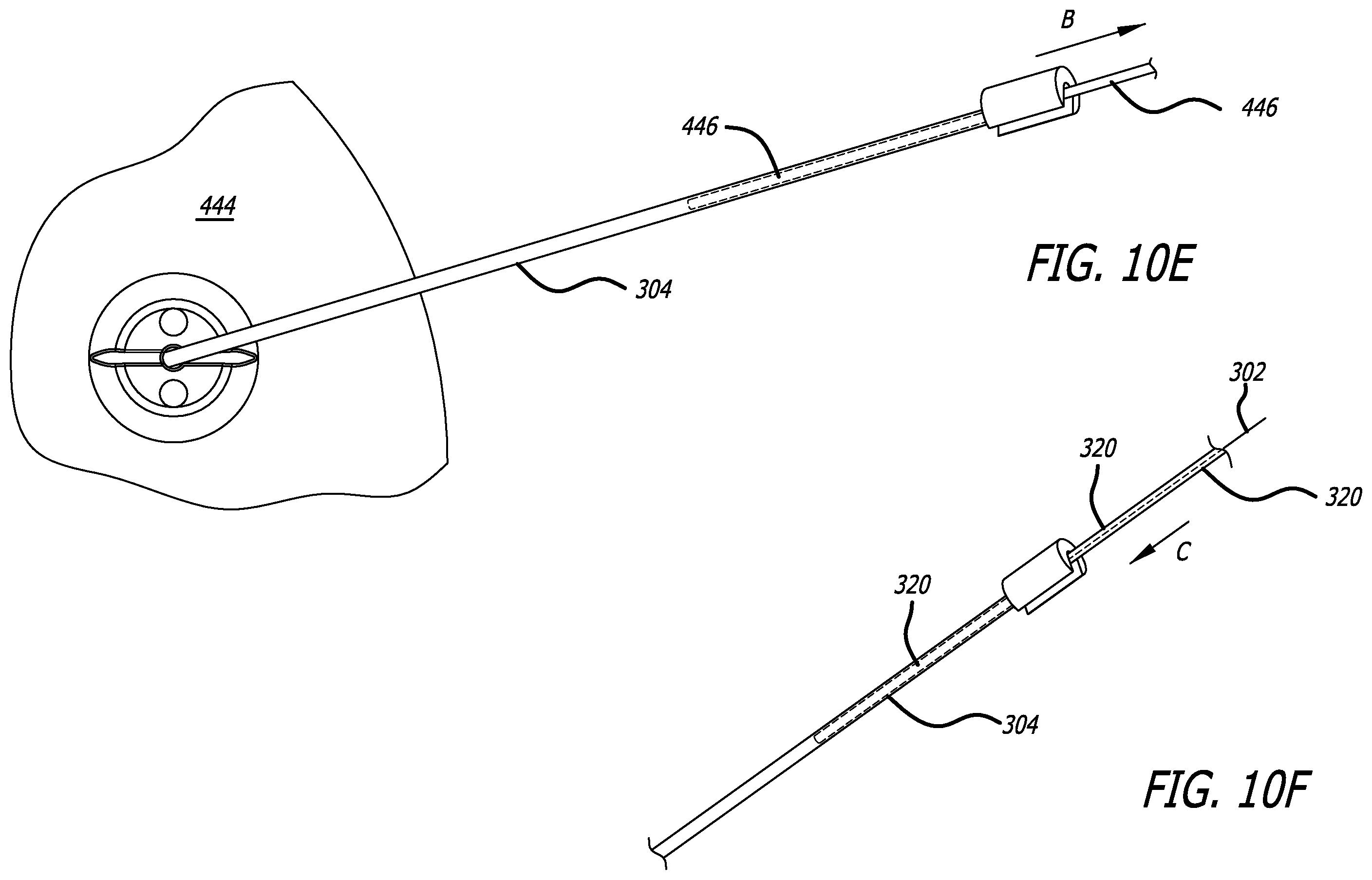 Patent US12403303 Figure 8 – Lead fixation devices for securing a lead to a cranium