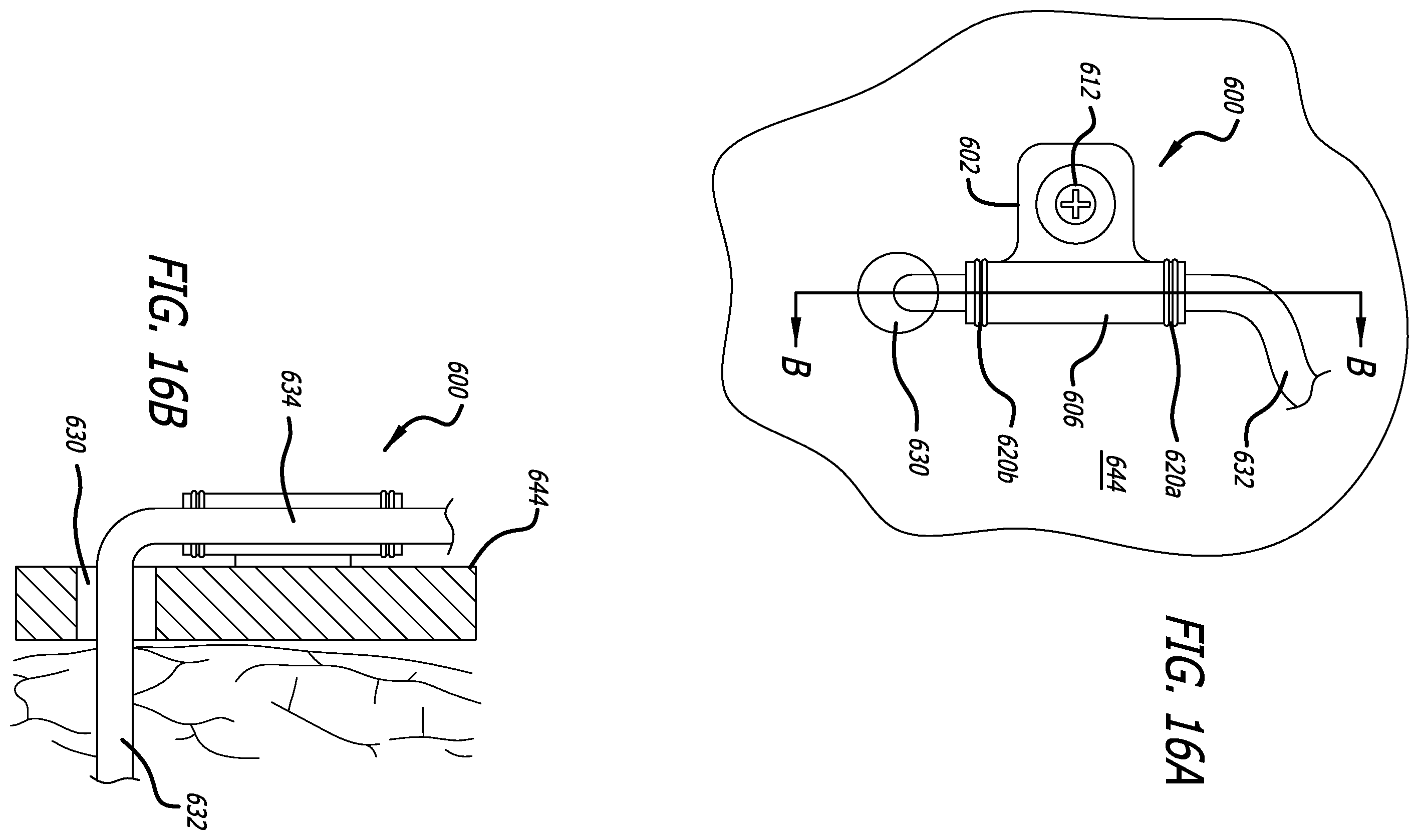 Patent US12403303 Figure 14 – Lead fixation devices for securing a lead to a cranium